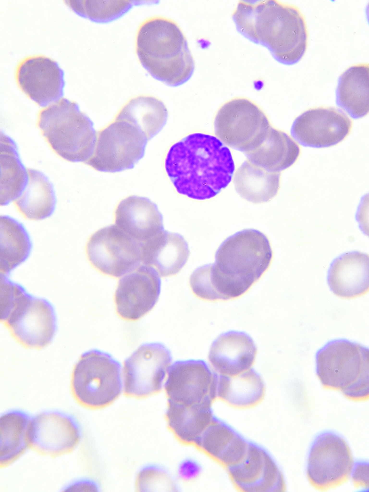 HE染色：清晰诊断的利器 - 优势与应用