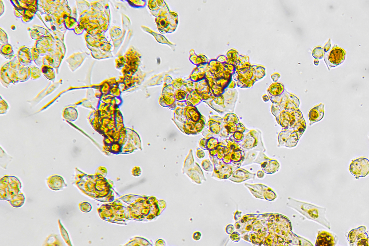 Tonsil Crypt Epithelial Cells: Definition and Importance