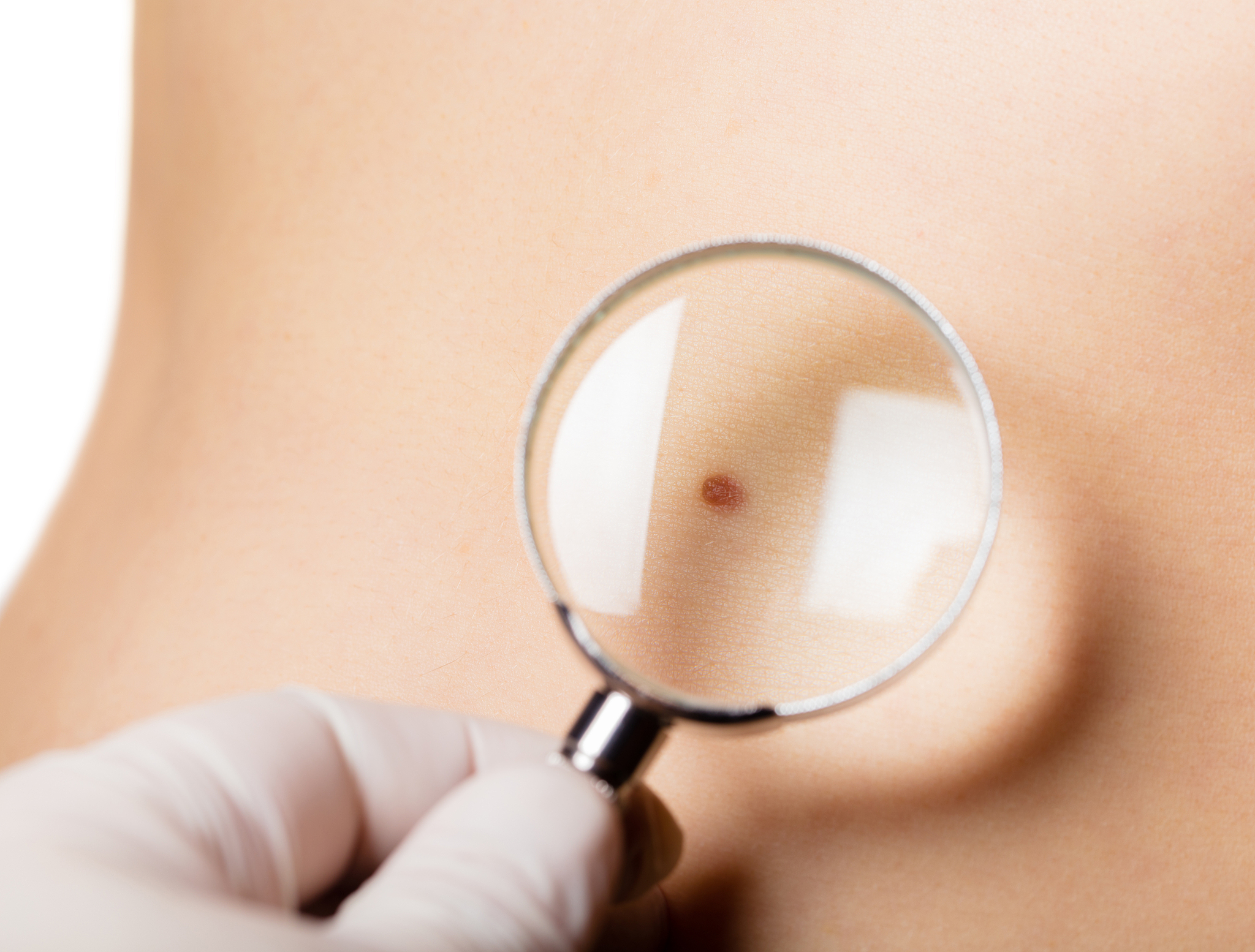 眉头长痣好不好？朋友说有福之人，怎么回复？