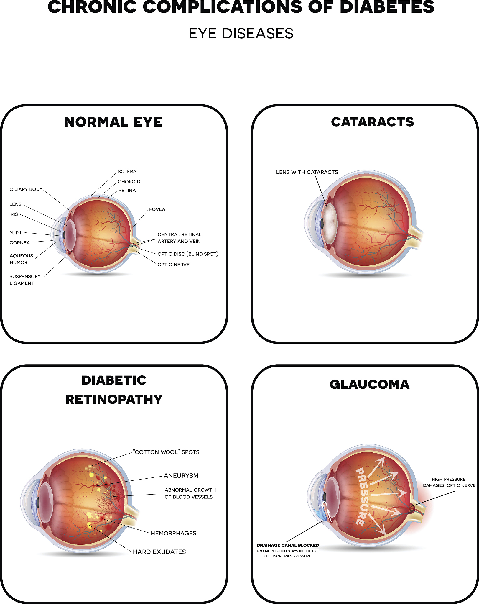 银杏叶滴丸在视网膜疾病—致盲性眼病方面具有潜在疗效-思维导图
