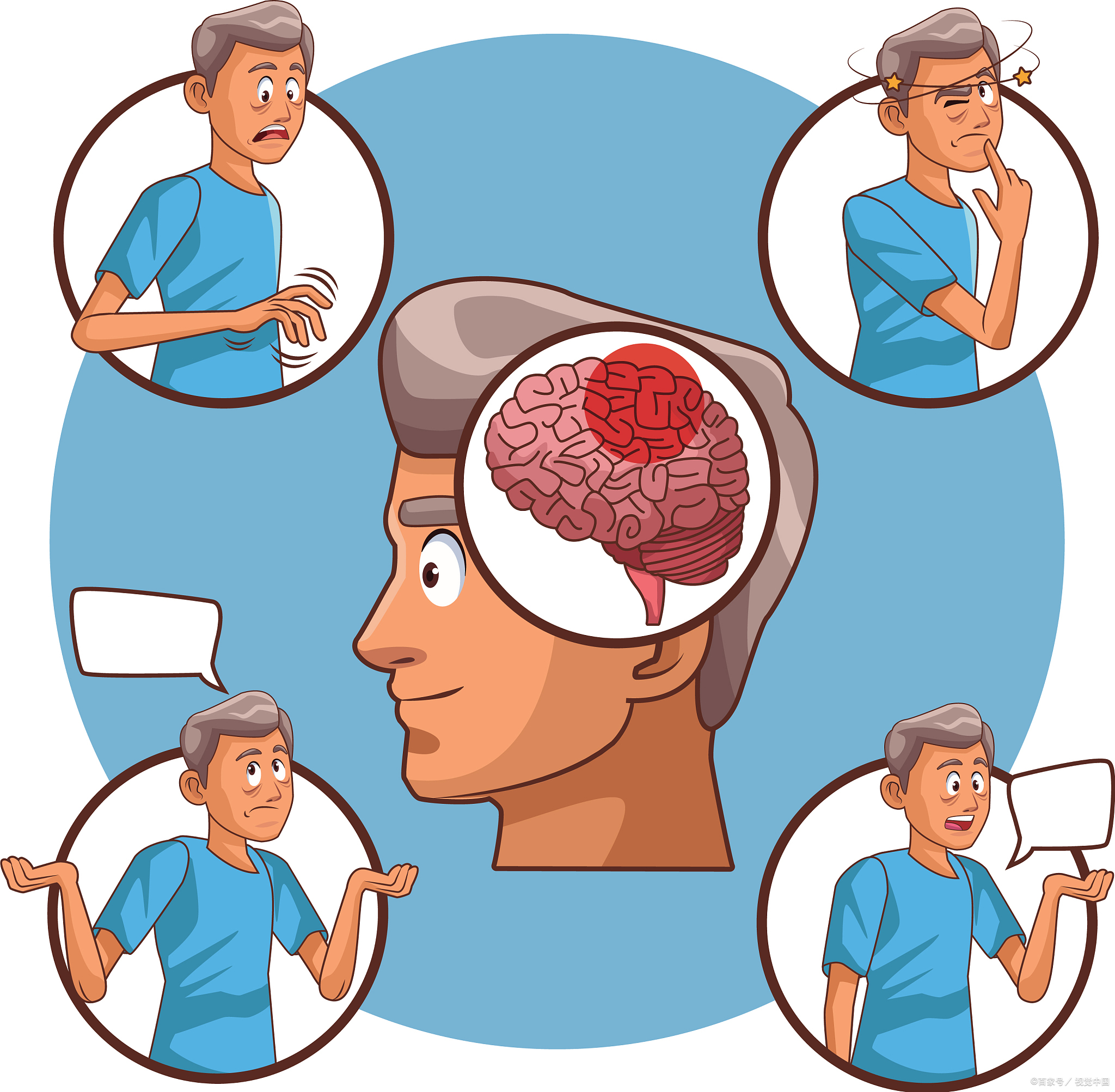 躯体忧虑/形式障碍是什么？