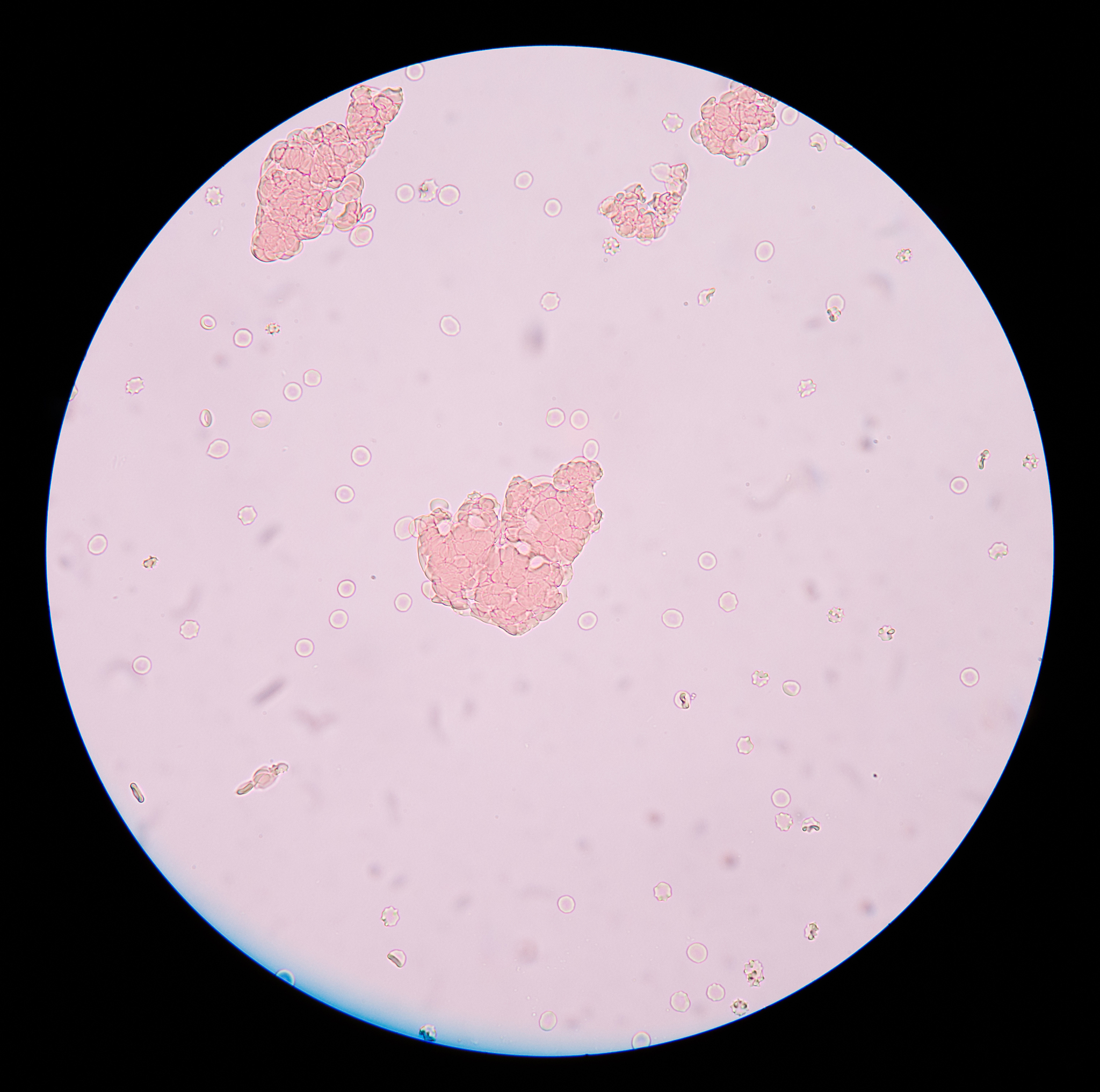 未知菌种鉴定方法：从血平板到分子生物学