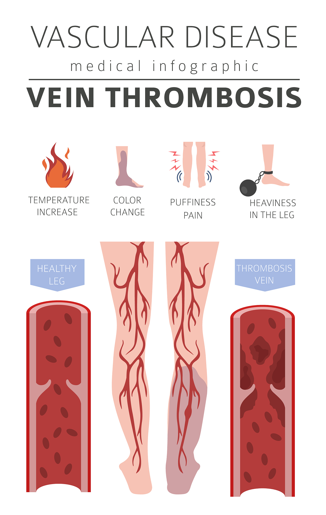血栓四项在社区医院体检推广计划书