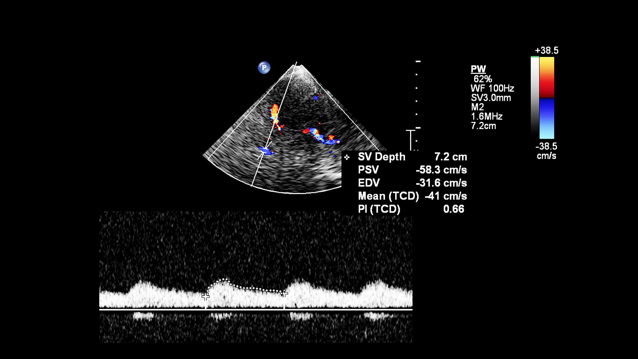 视网膜电压的产生机制：杆状细胞外段电流的细胞外流动