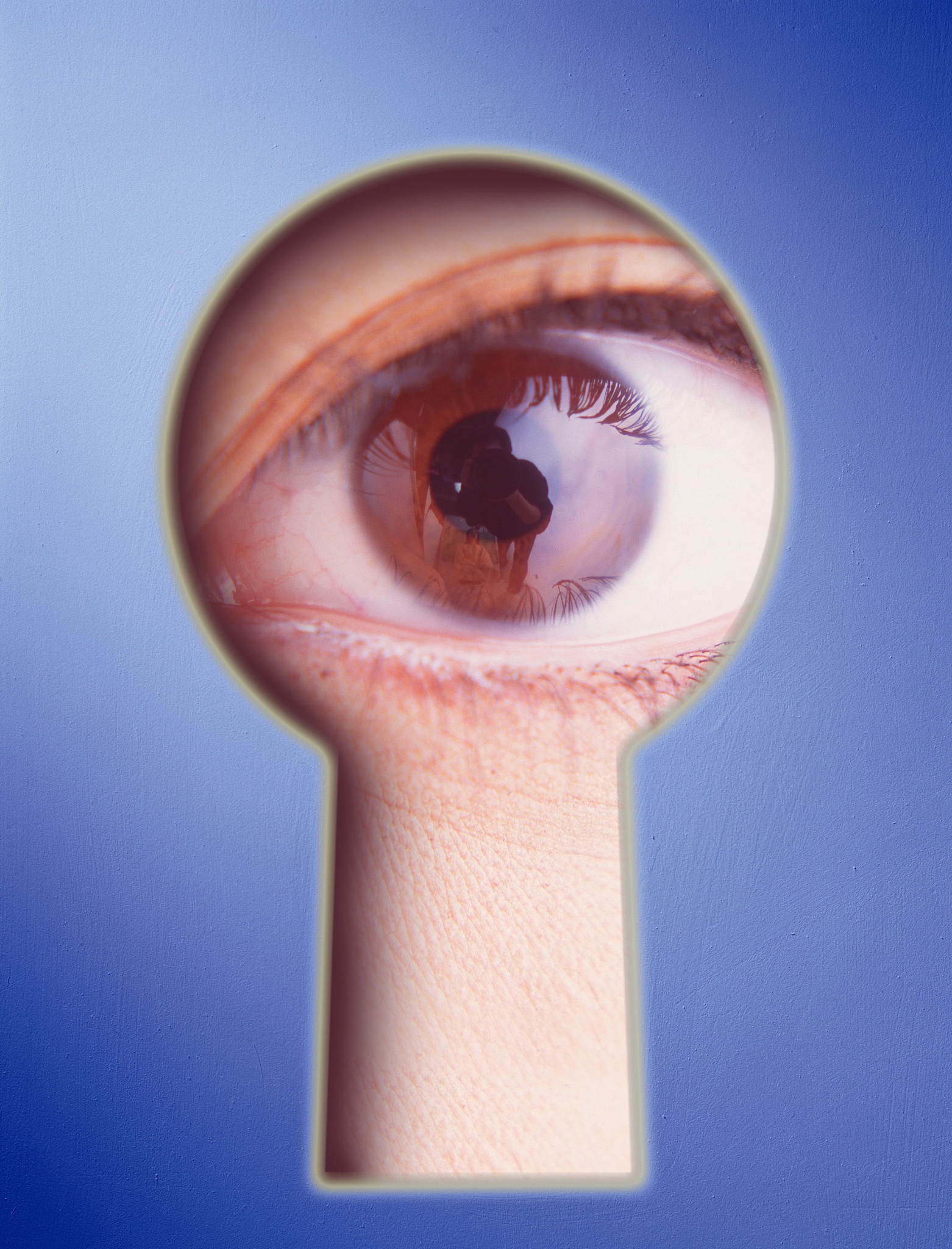 微小切口角膜基质透镜取出术后药物护理指南