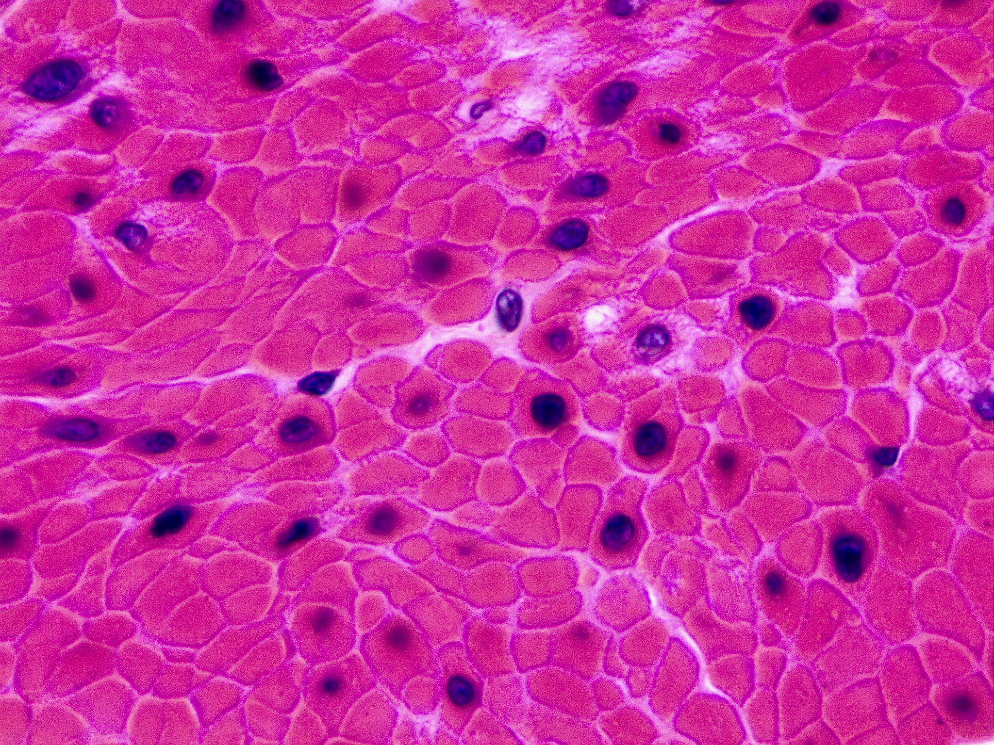 组织胺在抗过敏中的作用机理