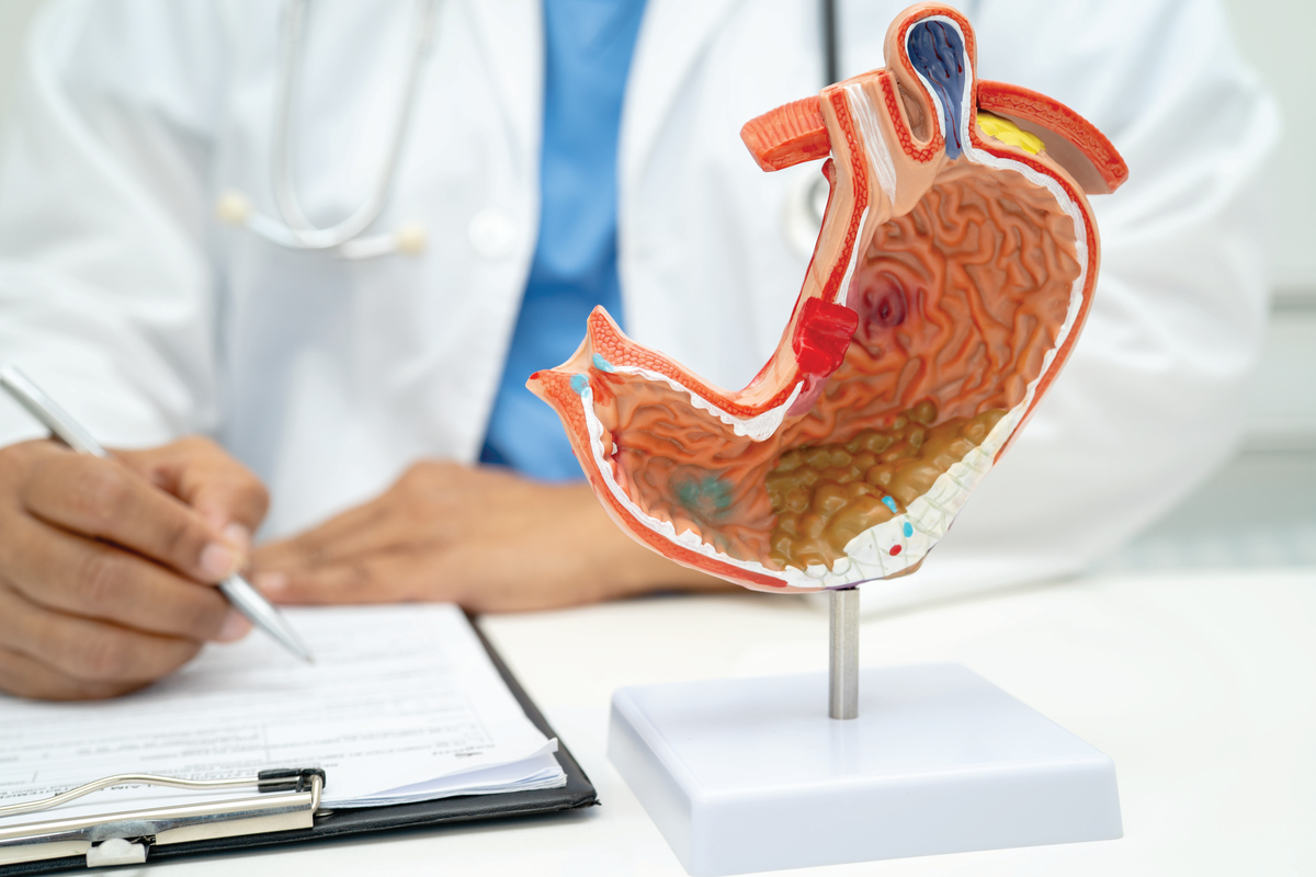 胃病恶化4个分层信号，占一个也要重视！