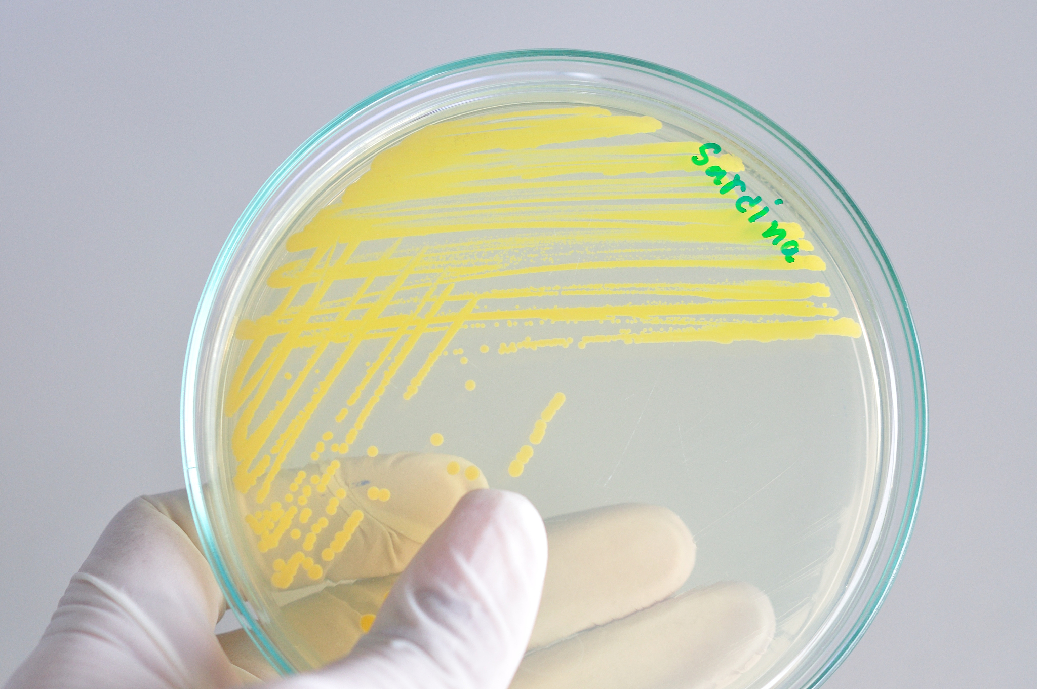 细菌胞外蛋白酶培养基选择指南