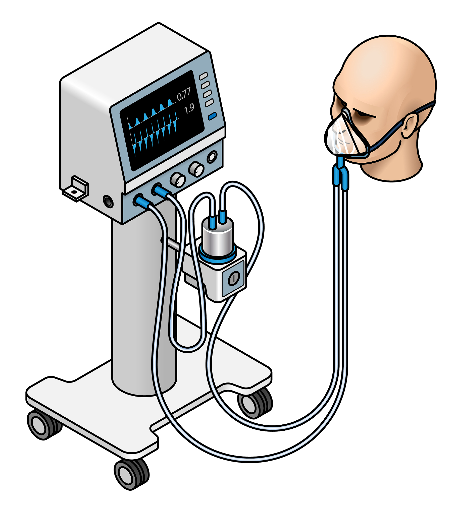 人工气道机械通气：原理、应用及注意事项