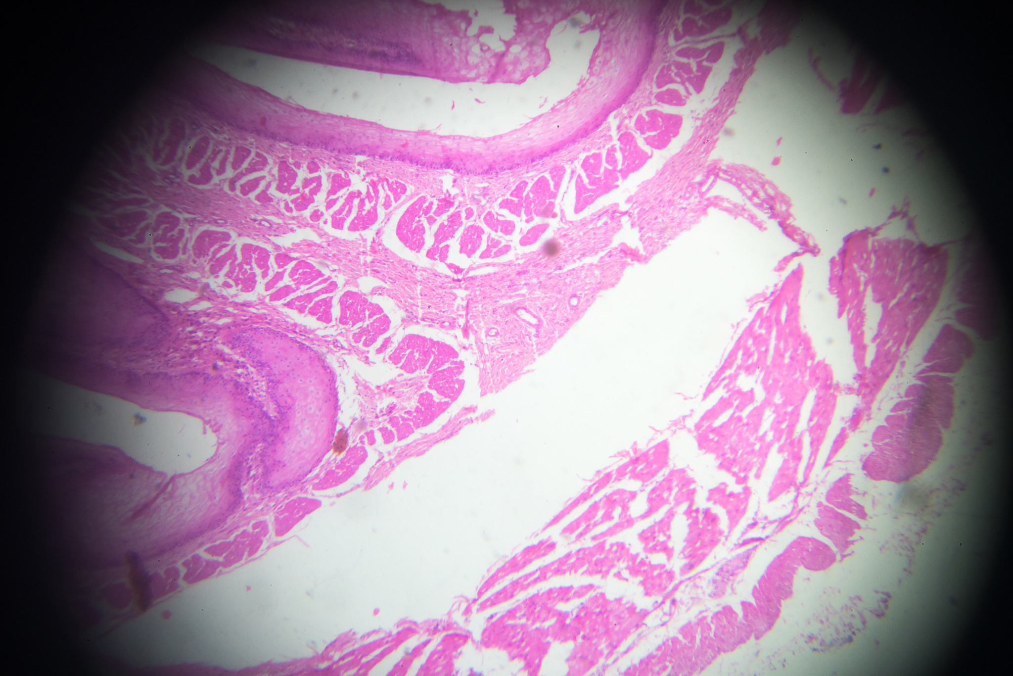 stratified squamous epithelium view in microscopy