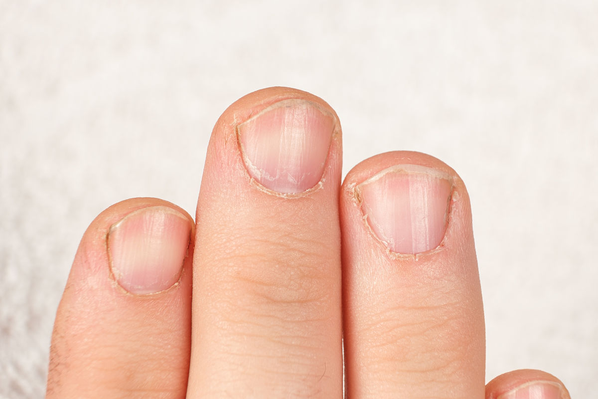 指甲上的月牙越来越少是怎么回事儿