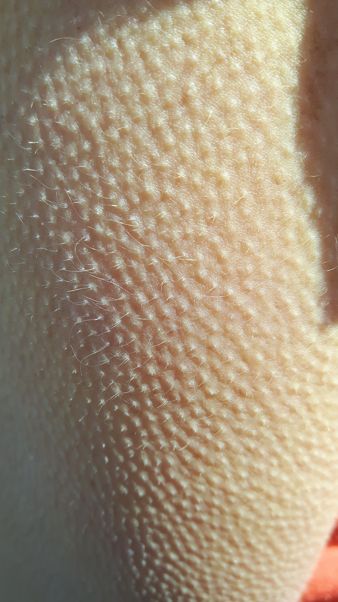 goose bumps closeup