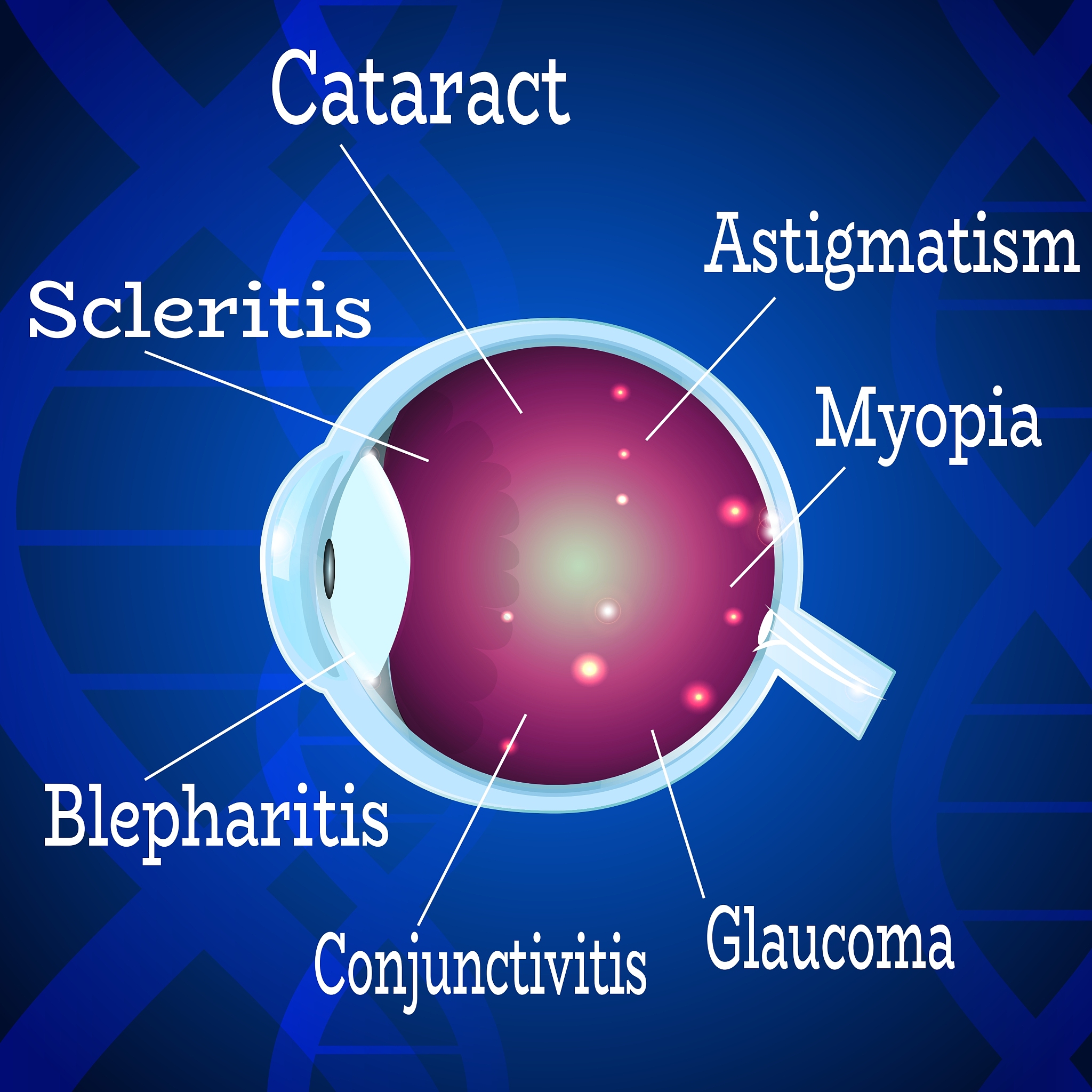 7	The	blind	spot	in	your	retina	is	located	where	a	there	are	rods	but	no	cones						 b there	are	cones	but	no	rodsc	the	optic	nerve	leaves	the	eye				 d	the	bipolar	cells	meet	the	ganglion	cells