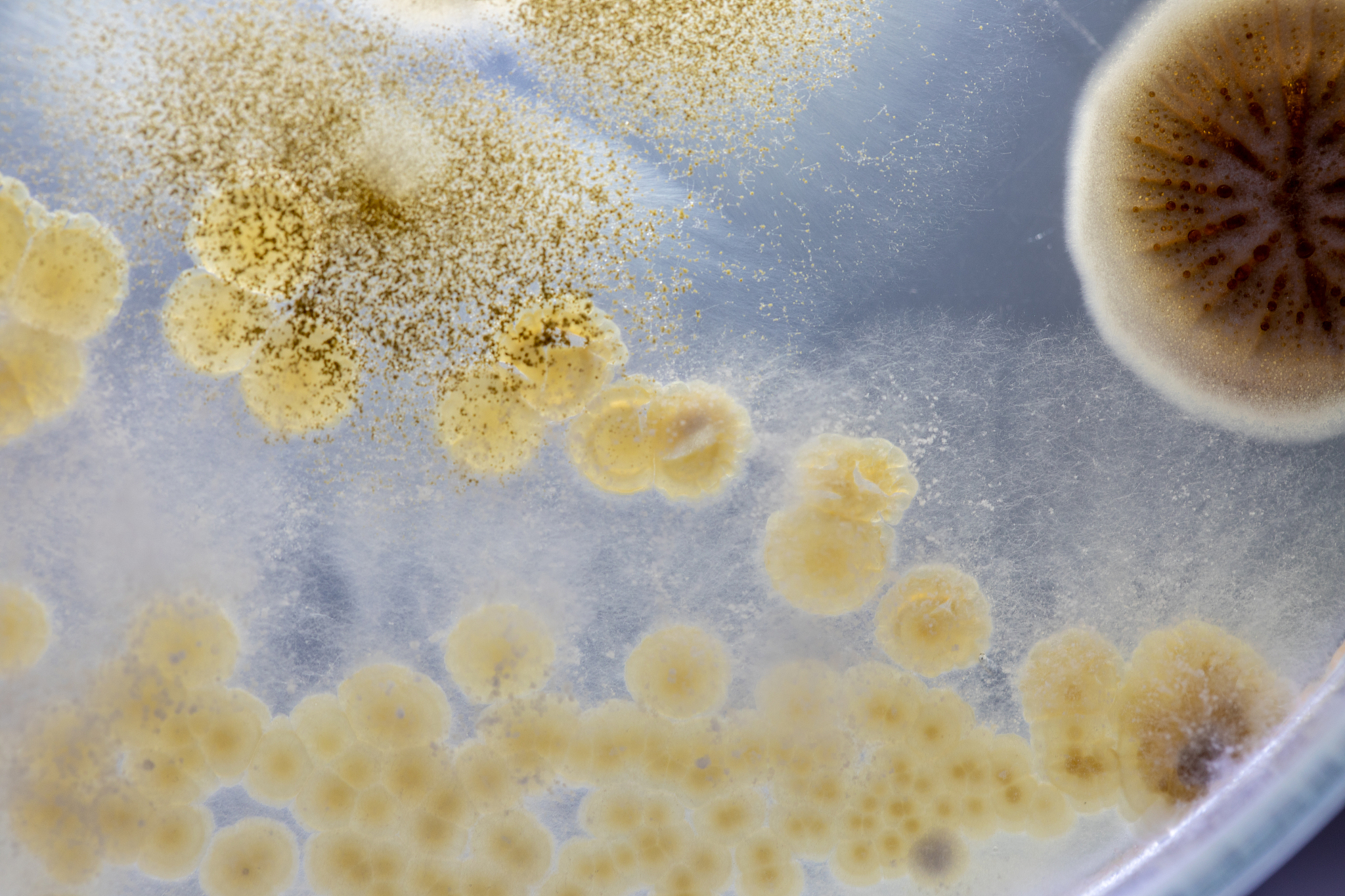 Chaetomium 真菌：室内外常见真菌属