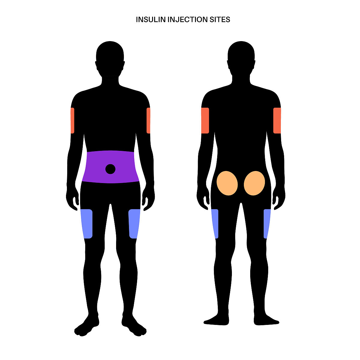 优伴笔注射几种胰岛素