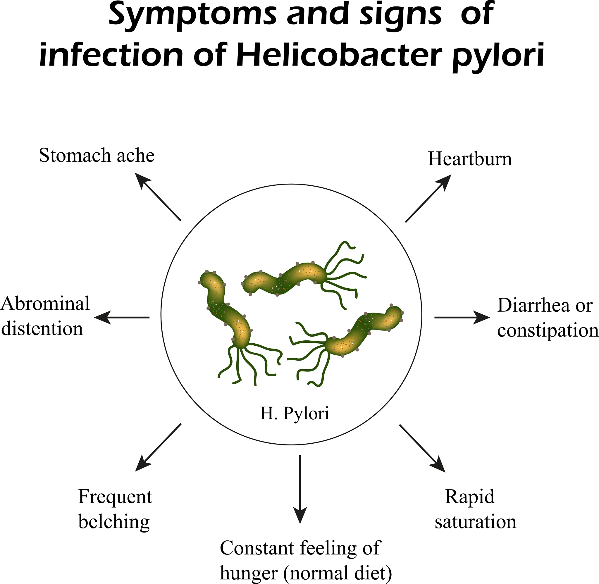 Establishment of Sect. Fargesiani (Phlegmariurus): A Phylogenetic Revision Based on Morphology and Molecular Data