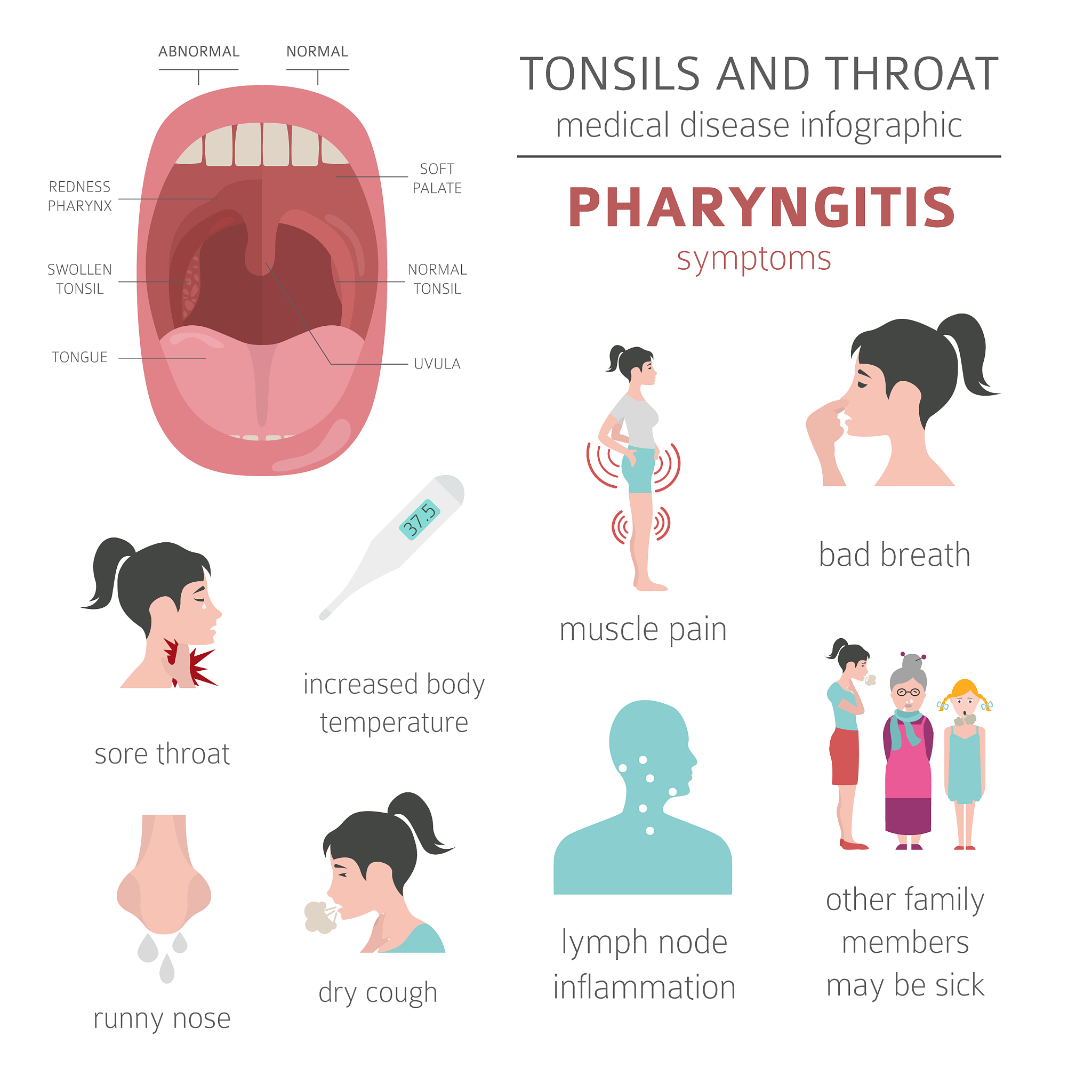 急性扁桃体炎症状及护理方法 - 缓解咽痛，快速恢复