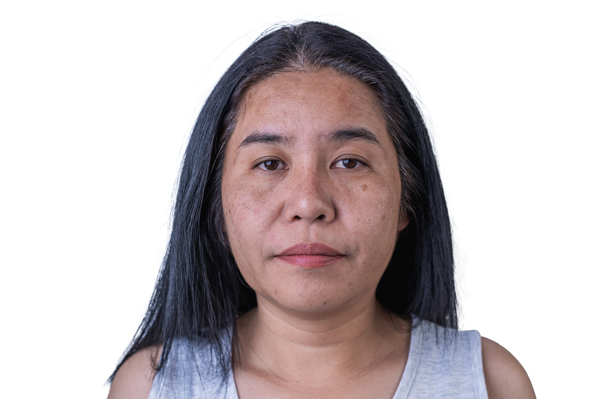 长时间面对电脑，皮肤真的会变差吗？