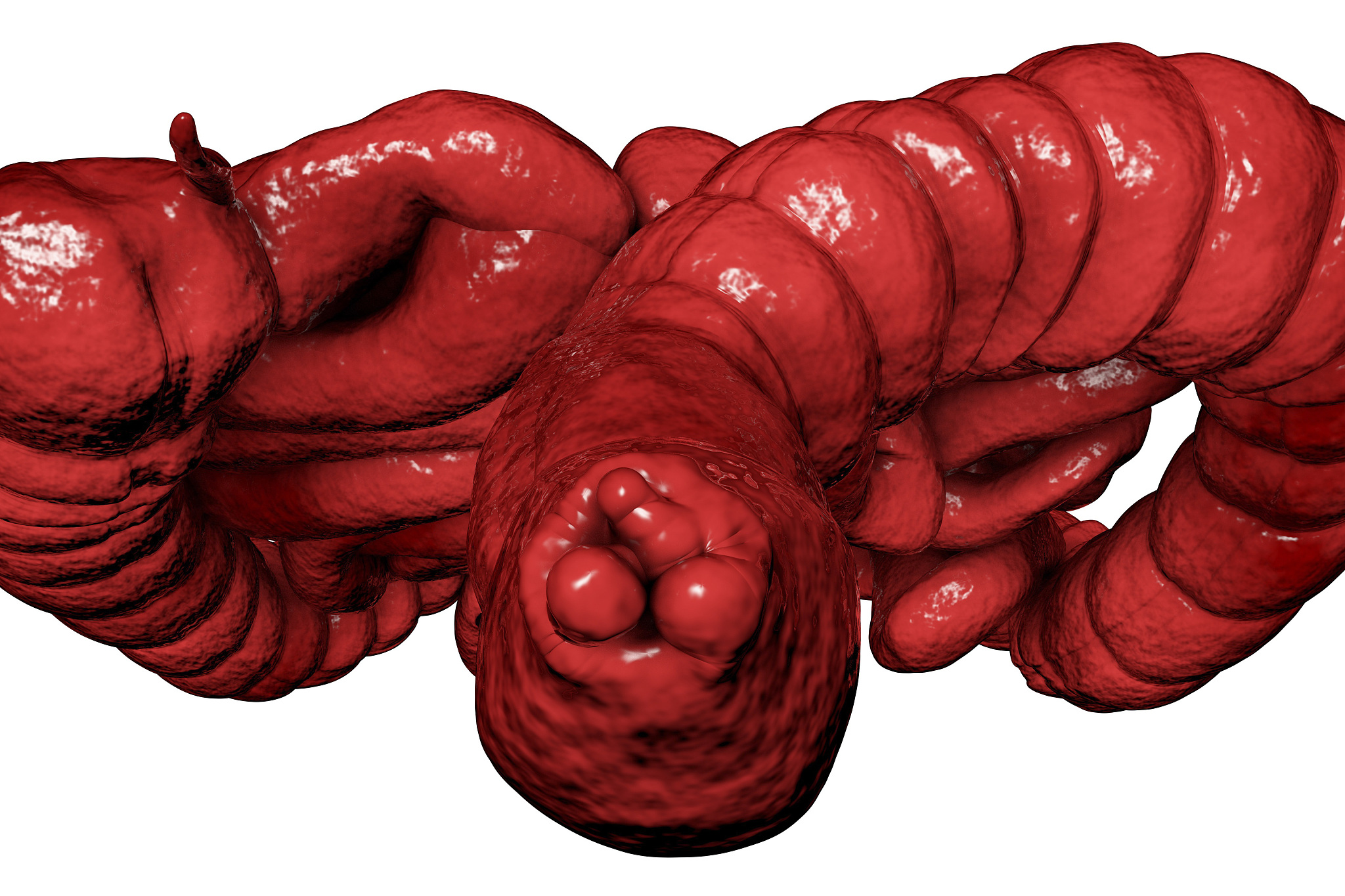 haemorrhoids, illustration