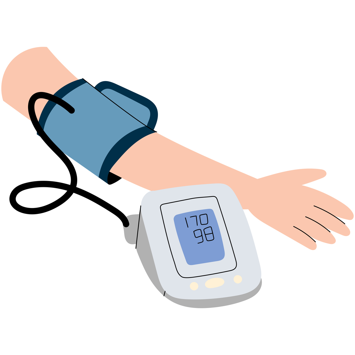 血压优化方案 高血压英文为 high blood pressure 或 hypertension。高血压的发生是因为大量血液想要通过血管而血管太窄或被斑块堵塞就会导致血压的上升。如果高血压得不到控制就会导致血管损伤久而久之就会导致心脏病发作、中风、血管疾病、眼睛损伤、肾病和勃起功能障碍等问题。高血压的发生和高血压导致的损伤通常没有任何症状因此高血压又被称为沉默的杀手。但它很容易被血压监测仪器检测出