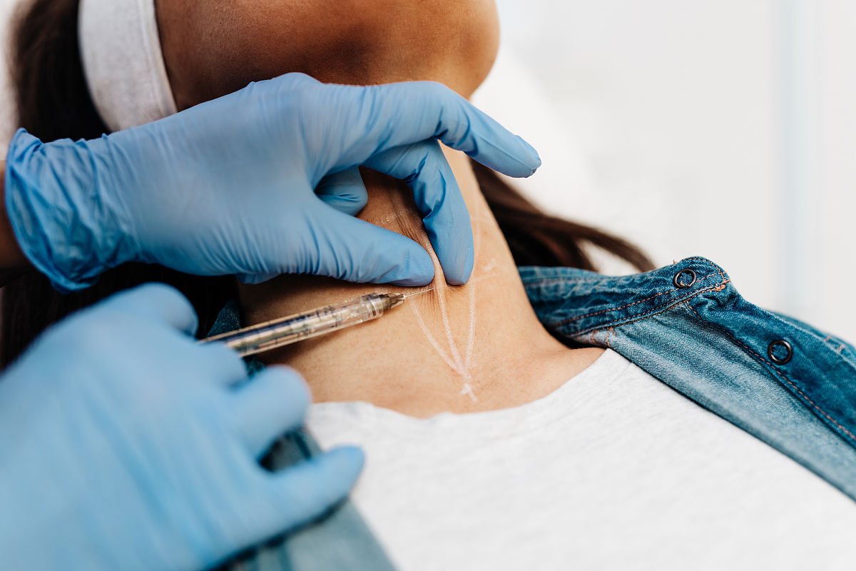 第五代热玛吉的原理和功效