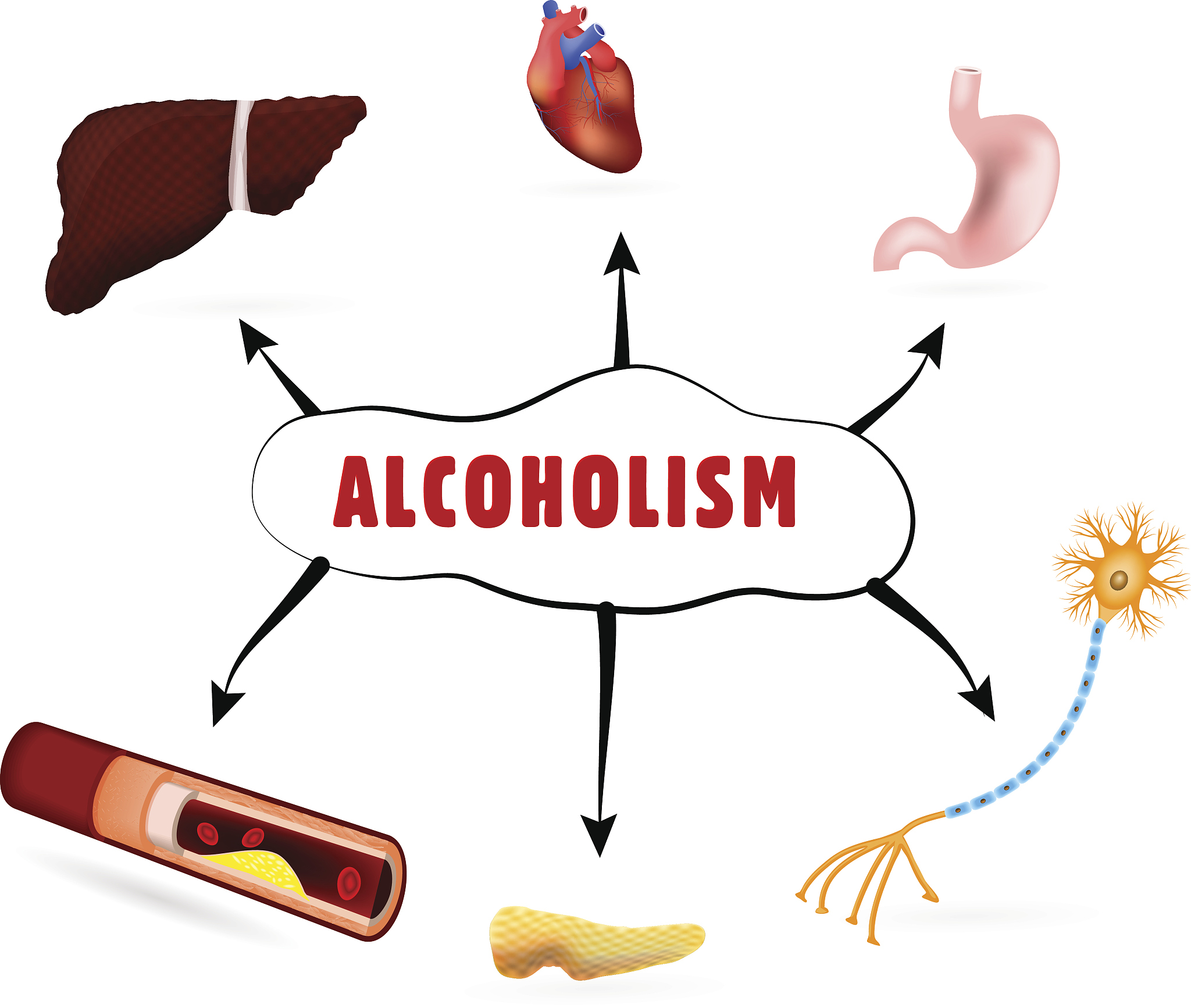 血清LDH及其同工酶测定的临床应用研究进展