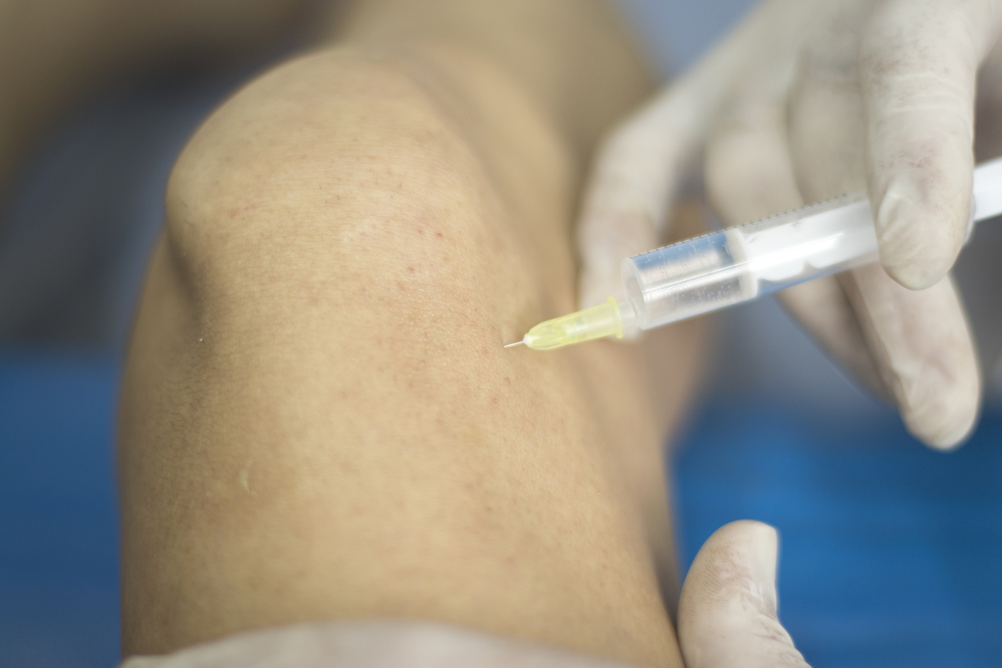 注射胰岛素笔皮下出血