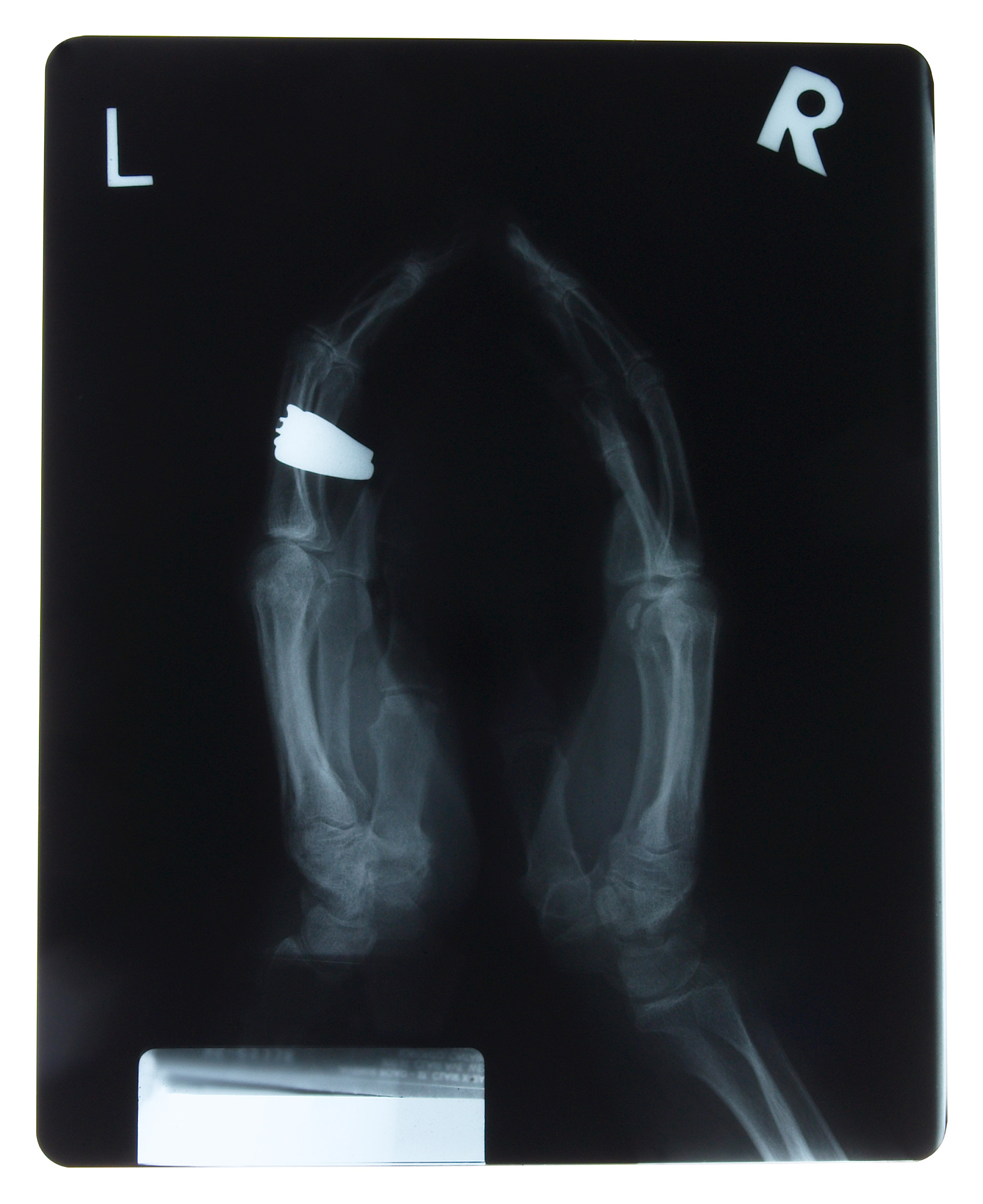 同工酶：催化相同反应的不同酶