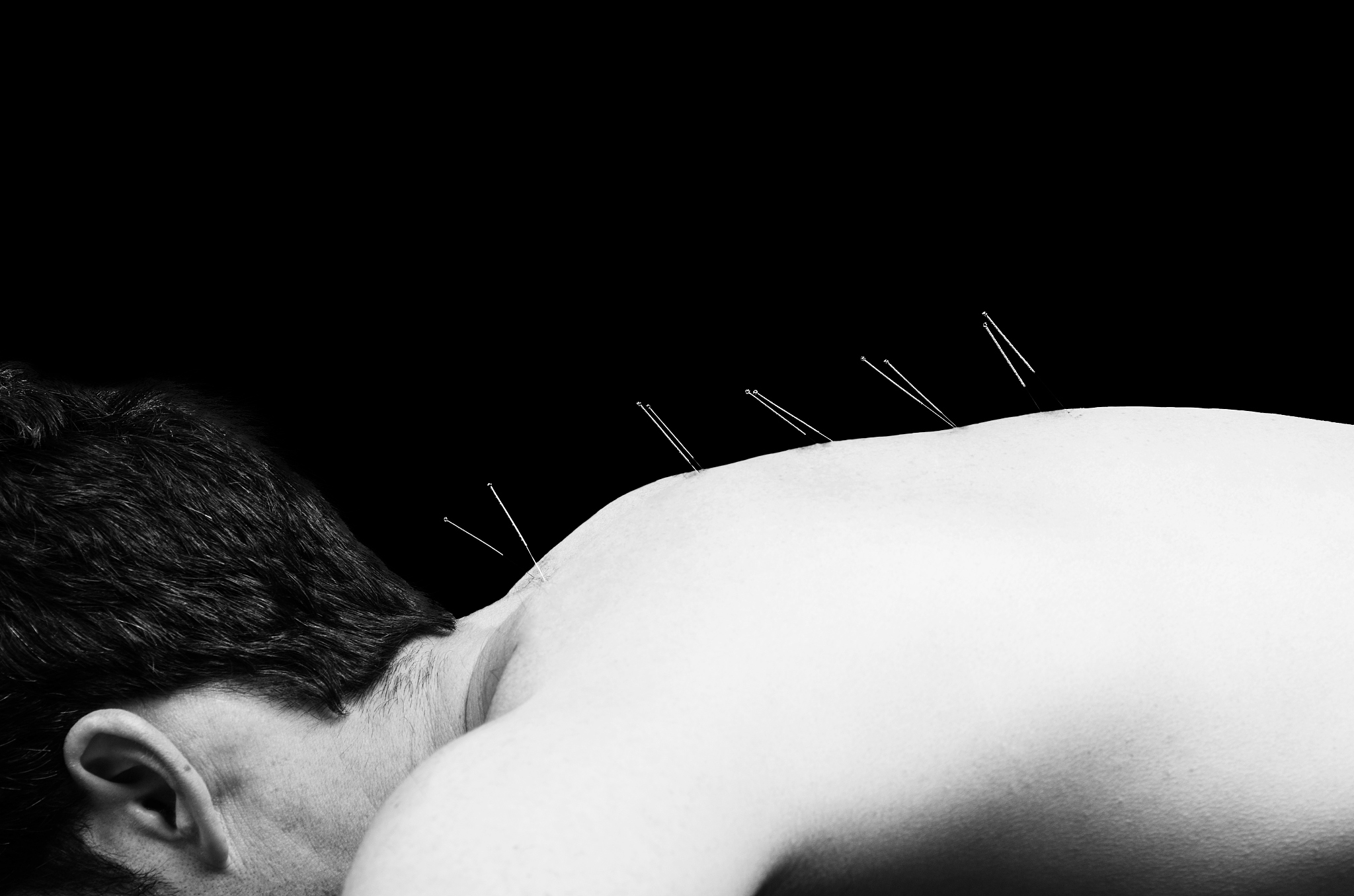 湖北中医药大学针灸推拿学专业：培养目标、就业方向及发展趋势