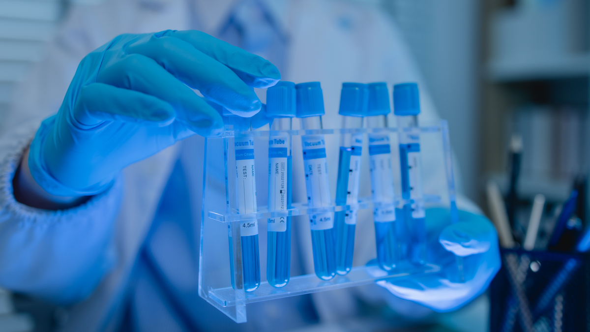 国产疫苗在后疫情时代不断走向世界的舞台RSV、VZV、influenza、RABV、HIV等相关传染病的研发都离不开创新疫苗技术的发展。ACRO为支持疫苗研发布局了基于ELISA的体液免疫检测试剂盒百普赛斯上线了哪些病毒的抗原抗体检测试剂盒？A	HBV influenzaB	HIV VZVC	NiV HeVD	RSV RABV