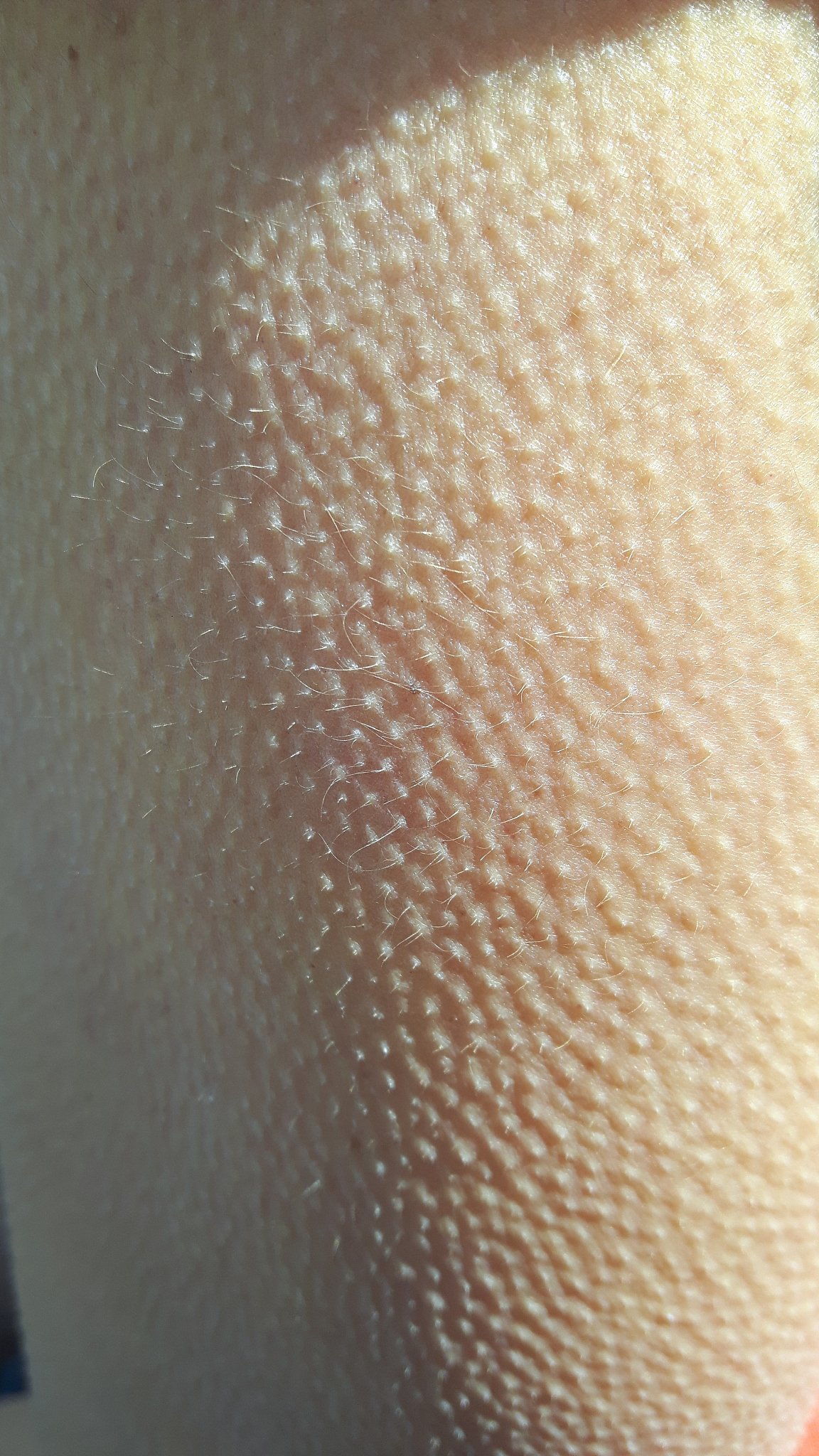 goosebumps closeup