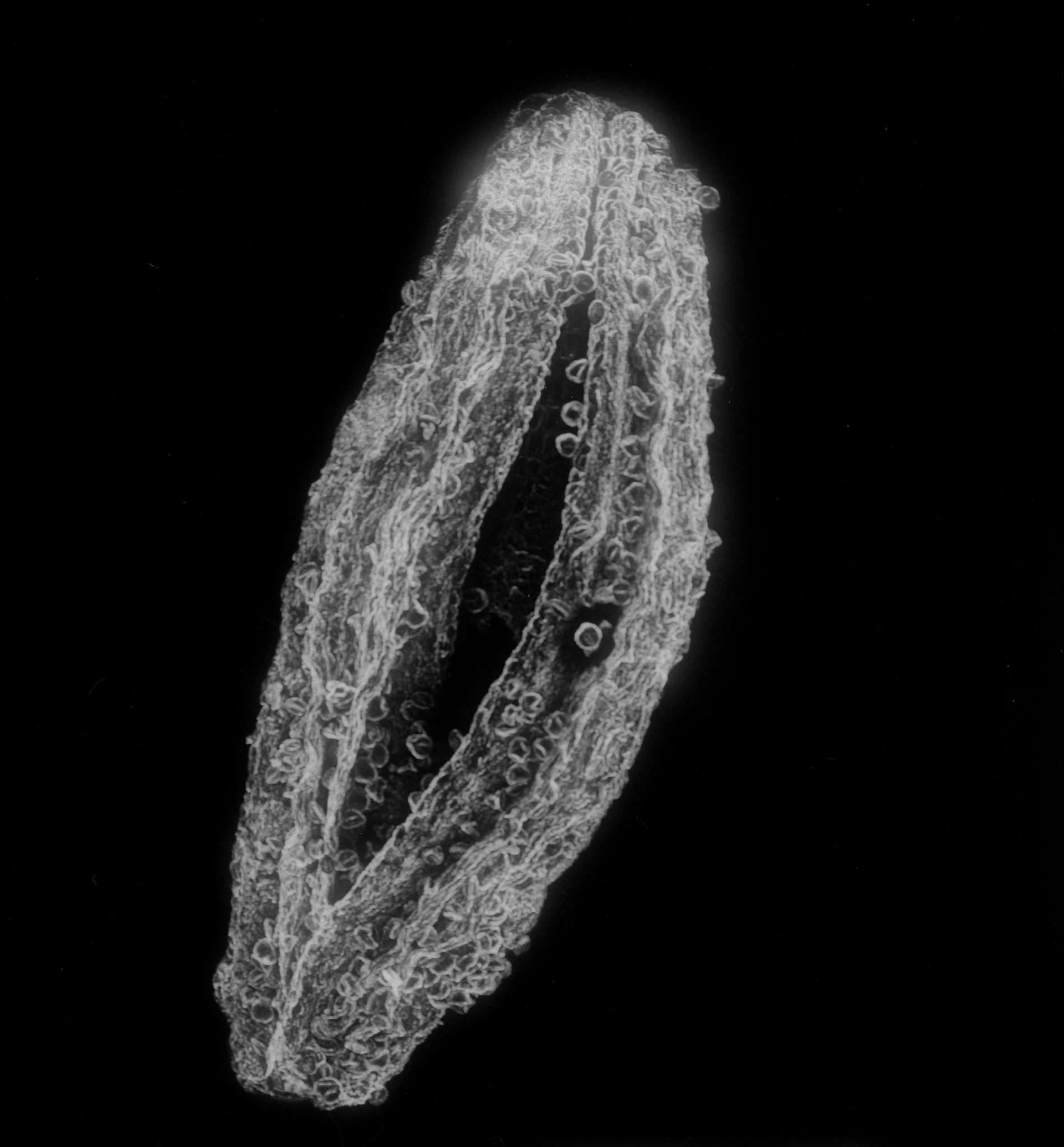 透射电镜发展史：从发现到原子尺度观察