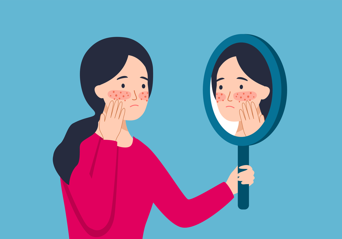 战痘多年？试试这些有效方法，跟痘痘说拜拜！