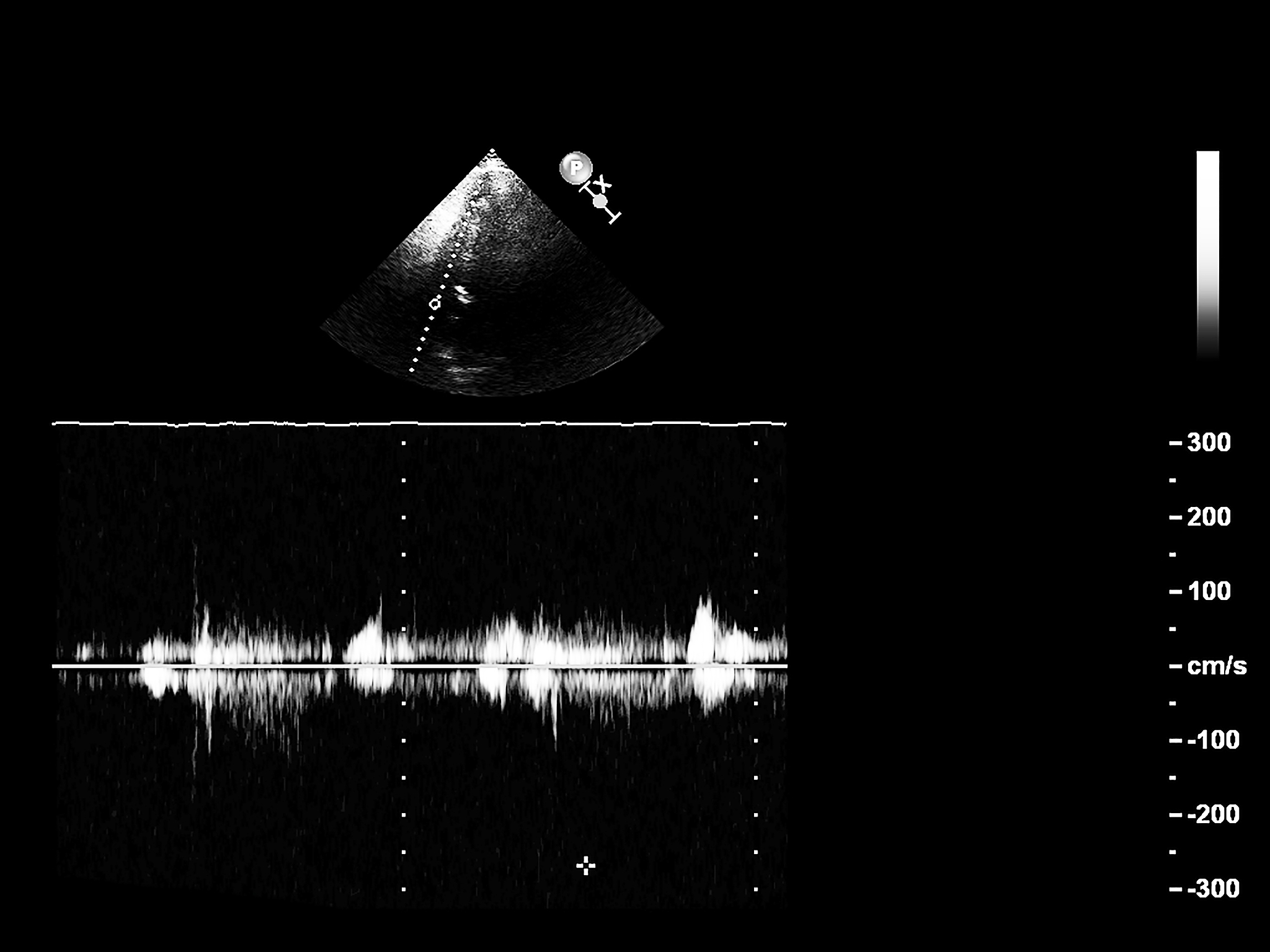 超声波和次声波能否在真空中传播？