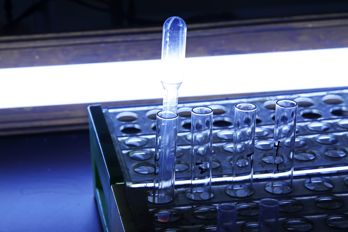 透明质酸电化学免疫传感器：识别核心、技术提升和应用前景