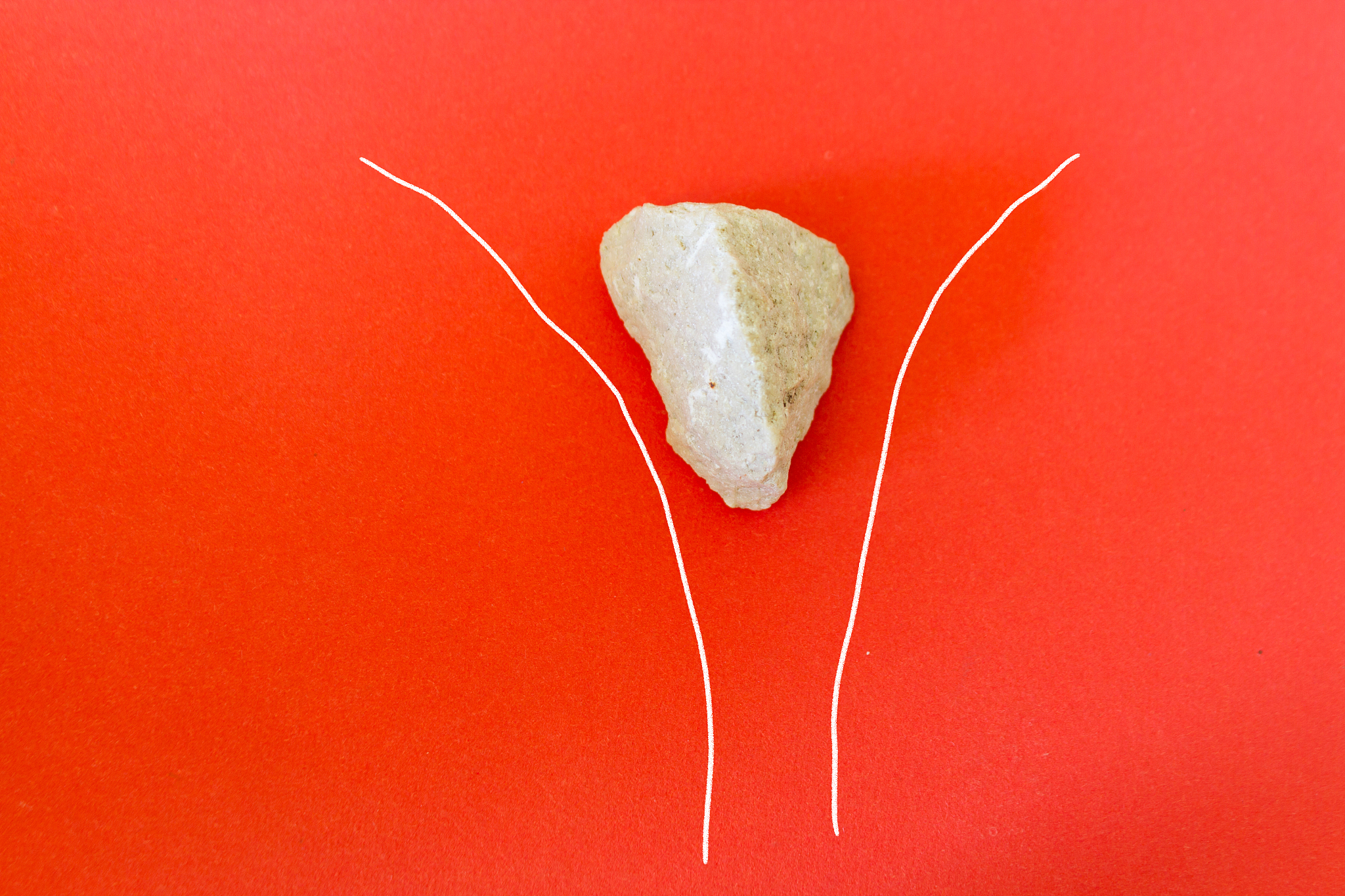 stone stuck in narrow place