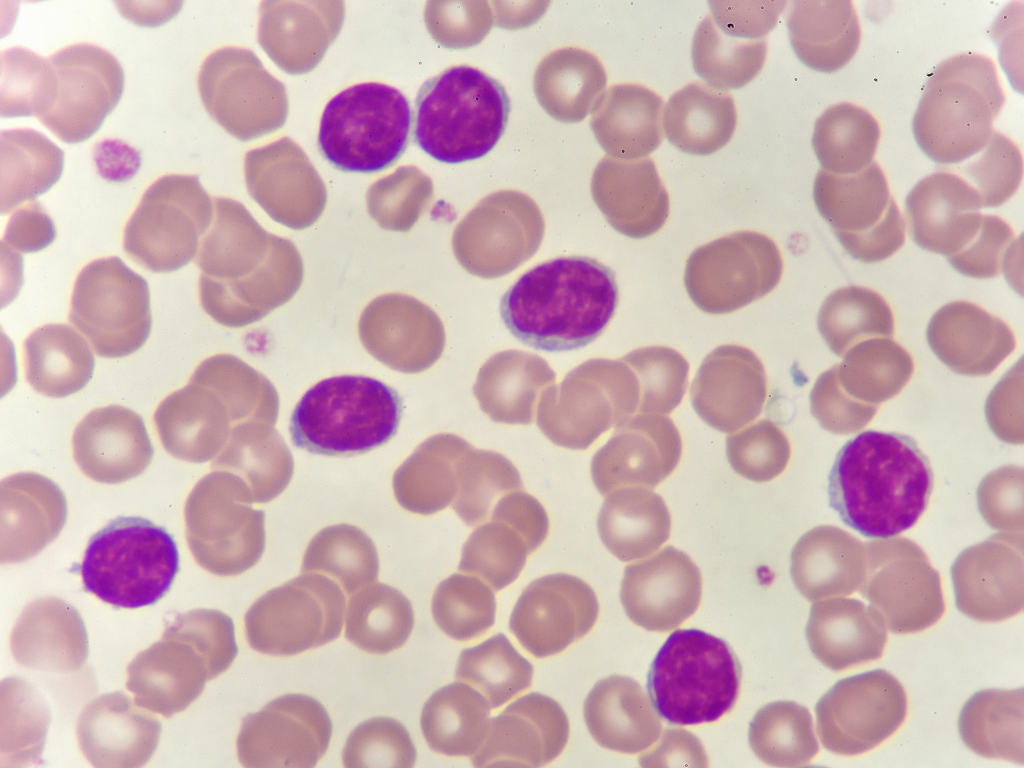 灵菌红素抑制金光色葡萄球菌诱导巨噬细胞炎症