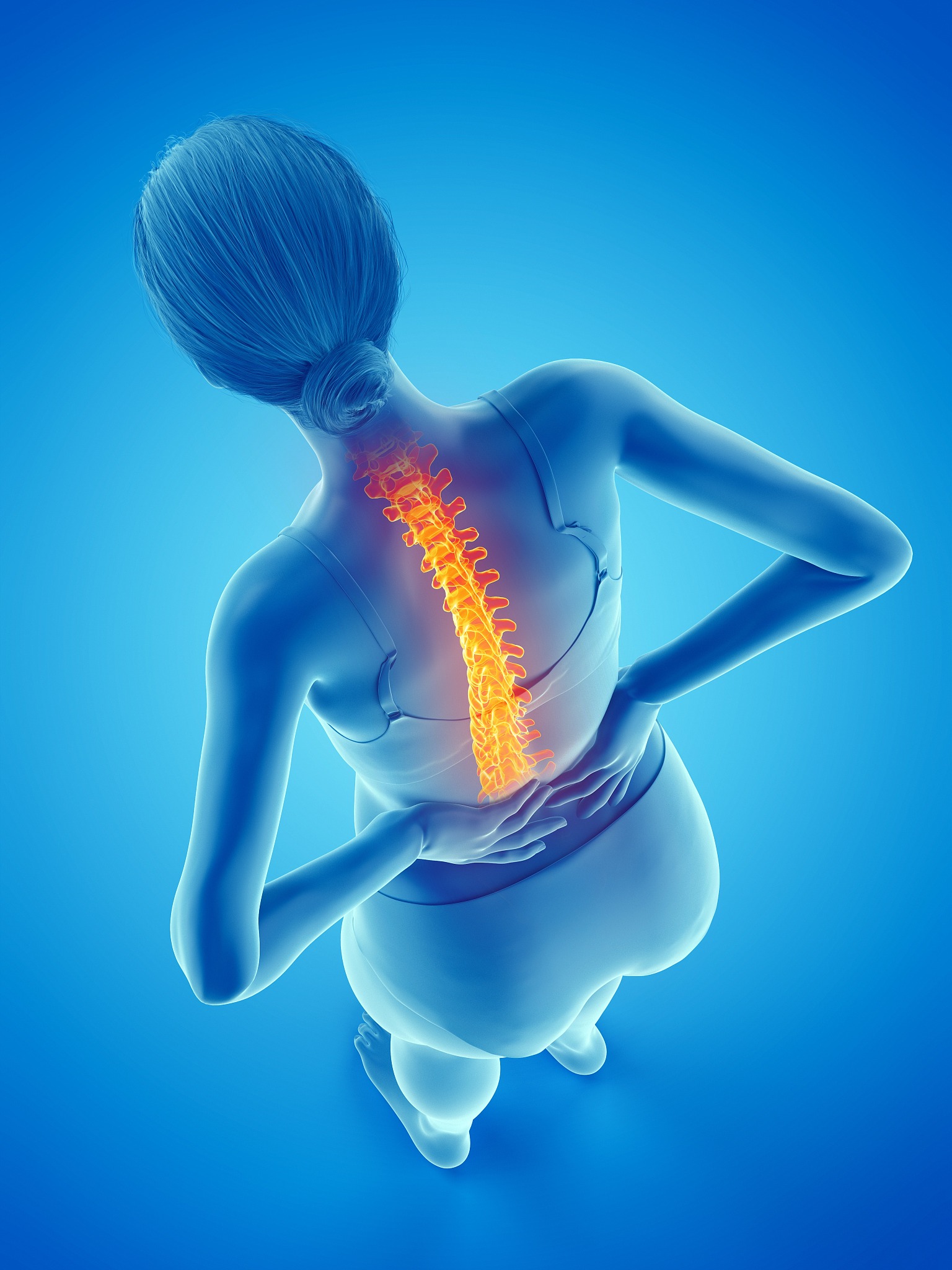 woman with a painful back, illustration