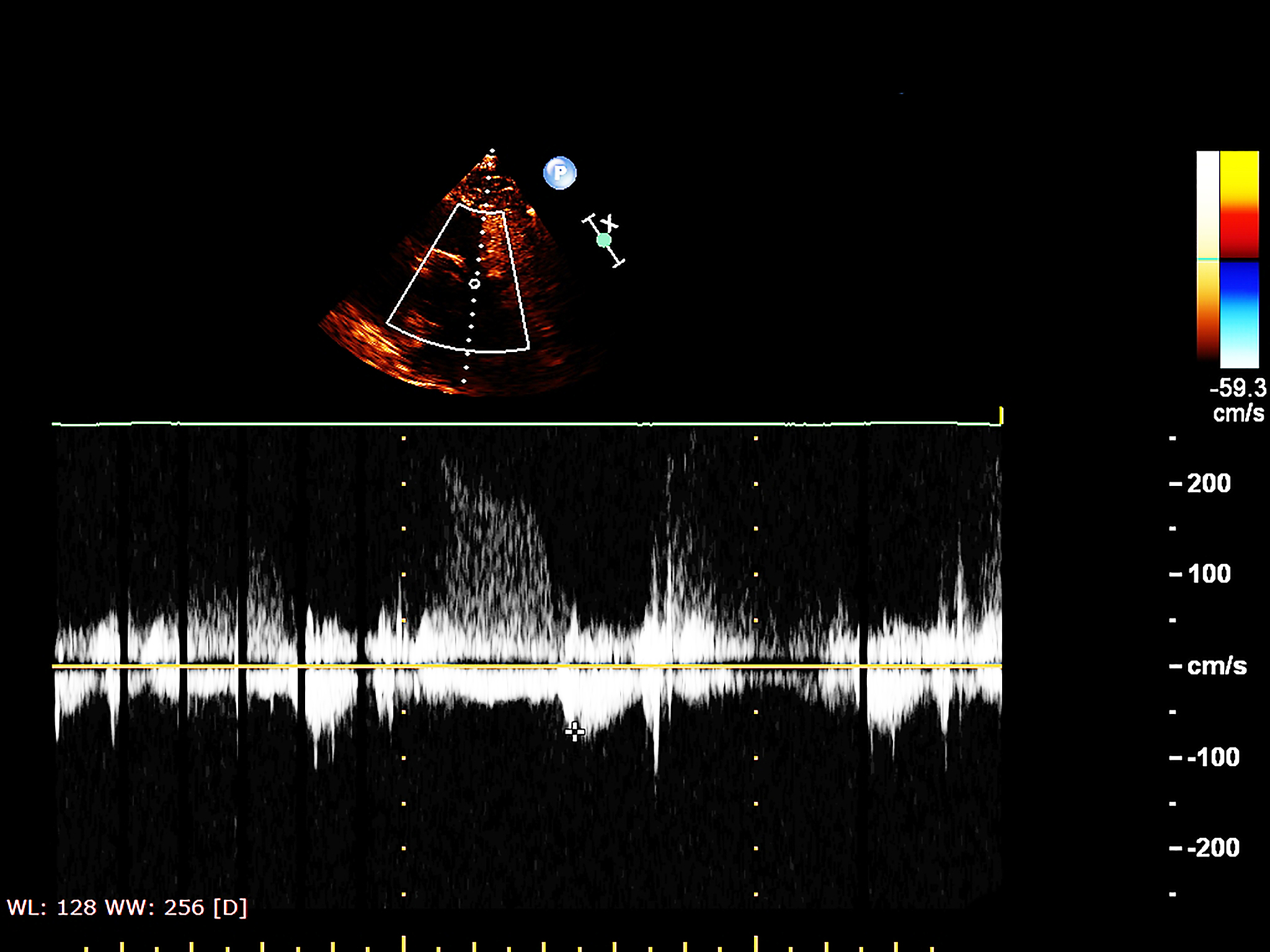 超声波和应力波什么关系