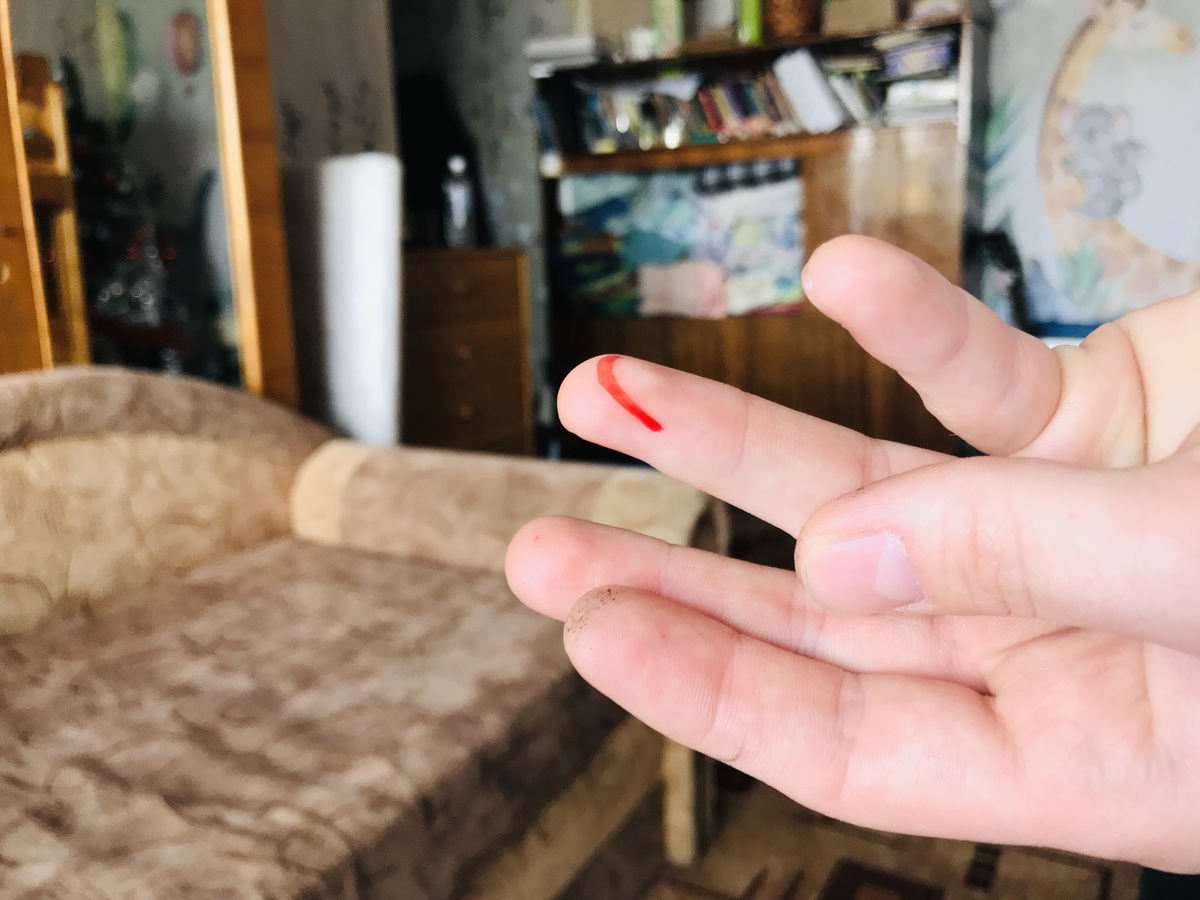 女朋友剪指甲流血了，如何幽默回应？