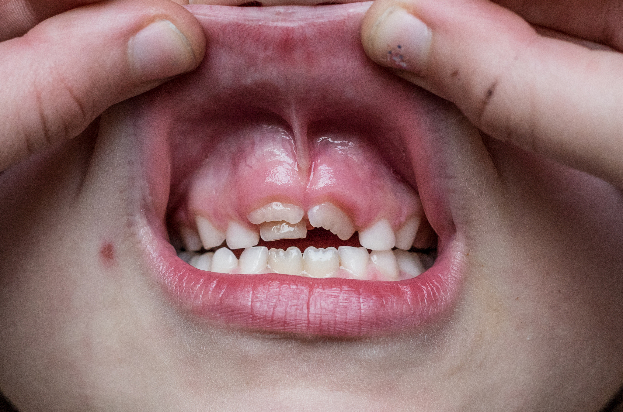 黔南民族卫生学校口腔医学技术专业2022年招生简章