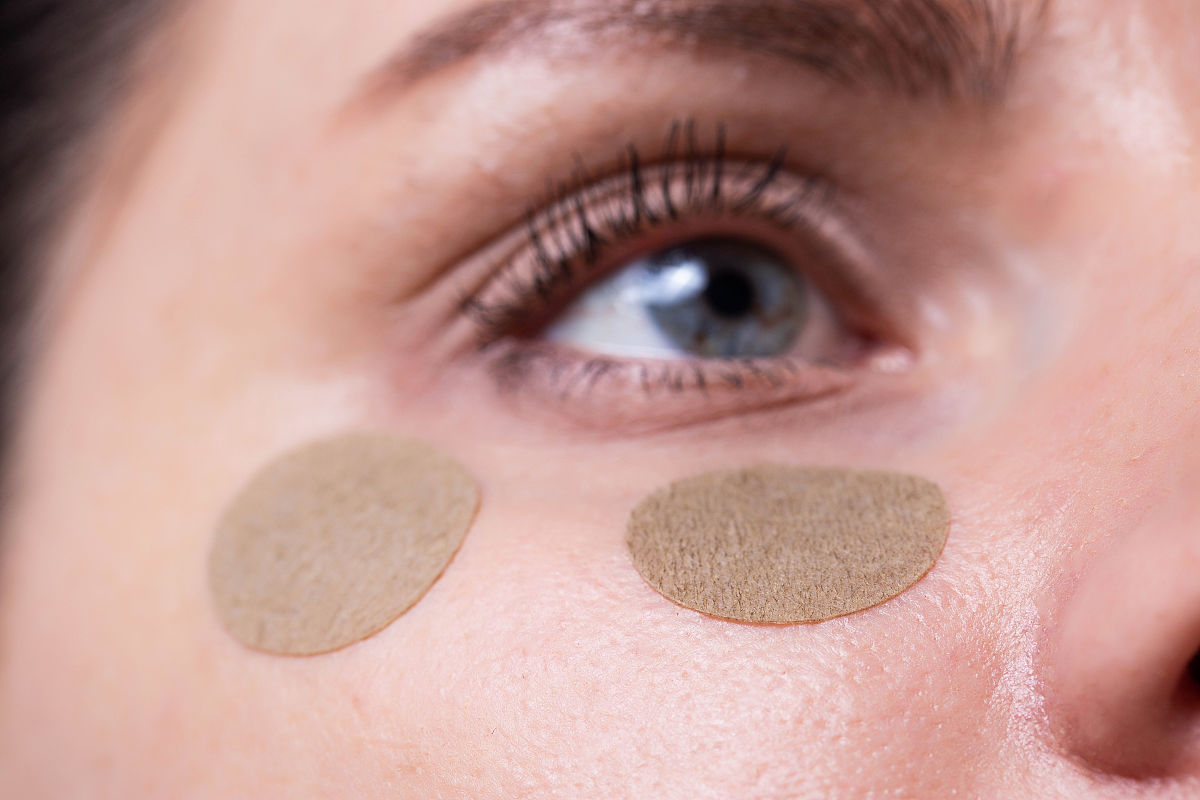 怎样去除黑眼圈？