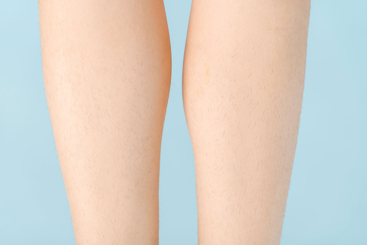 女生有腿毛代表了什么？