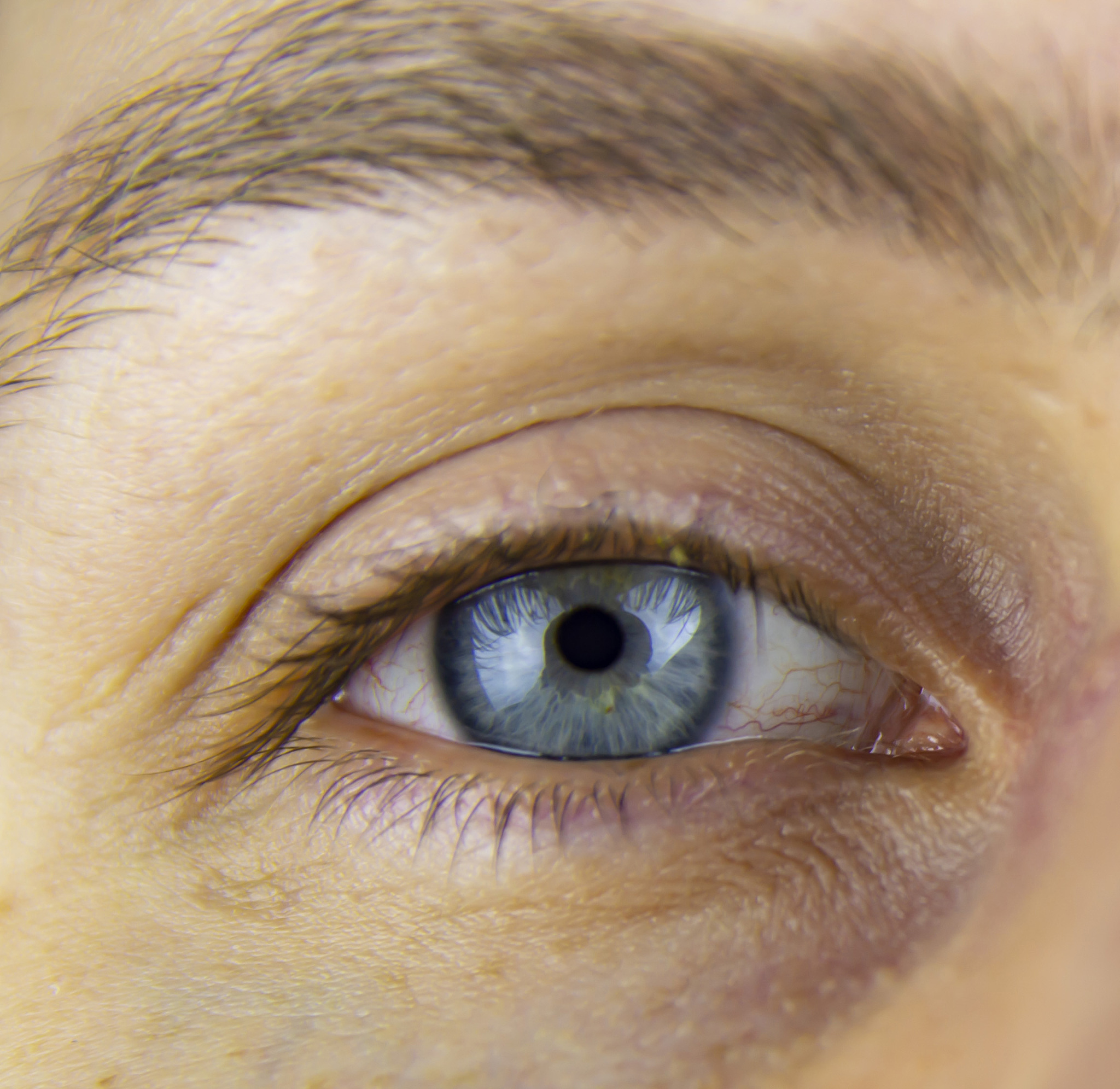 眼球上长白色颗粒是怎么回事？