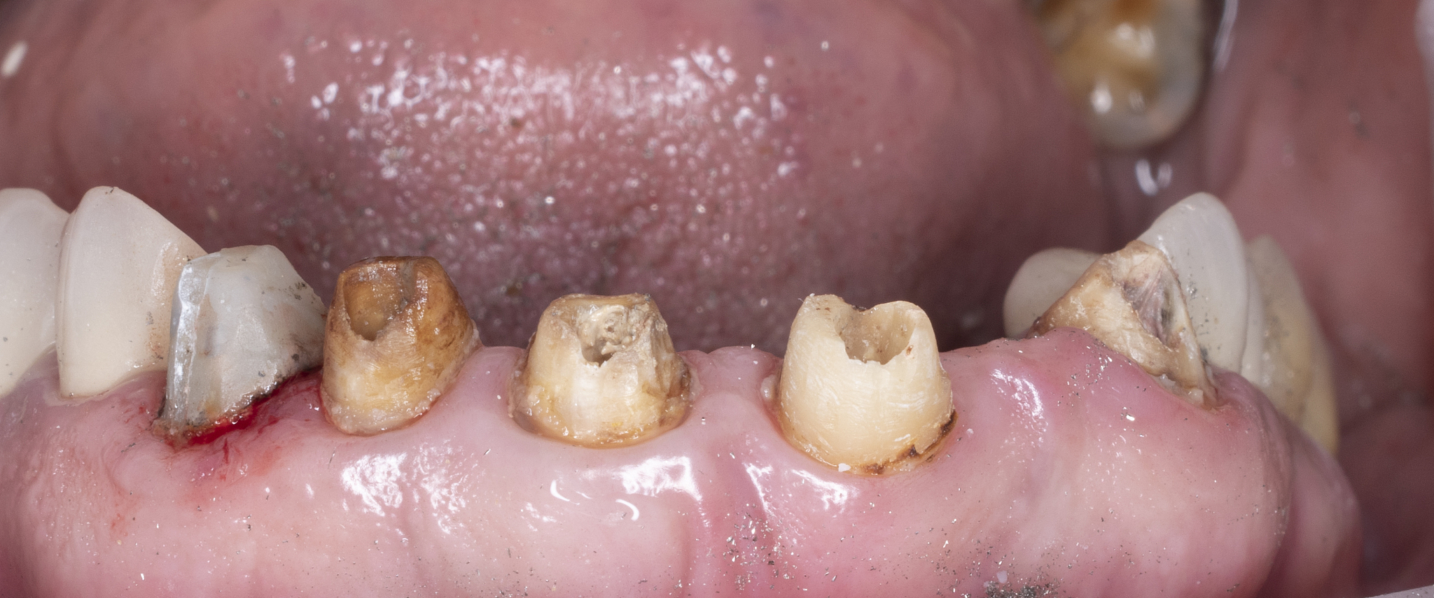 重庆口腔修复工艺专业护士学校 - 培养口腔修复人才的摇篮