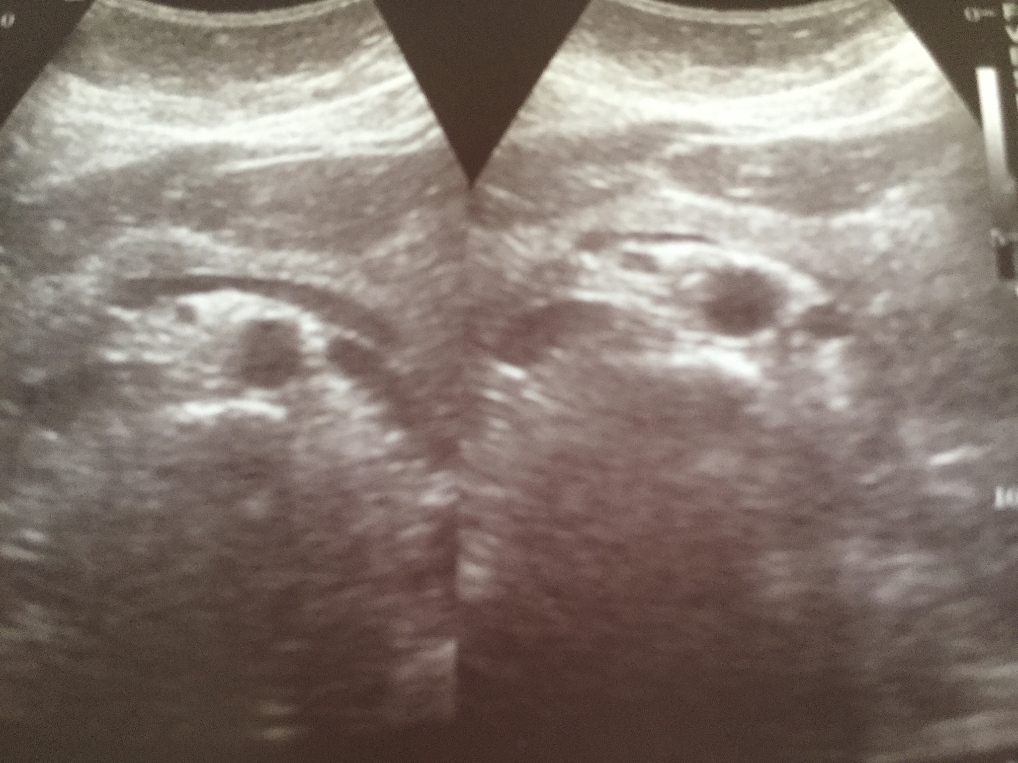 超声数据集 BIRADS 分类图：诊断利器