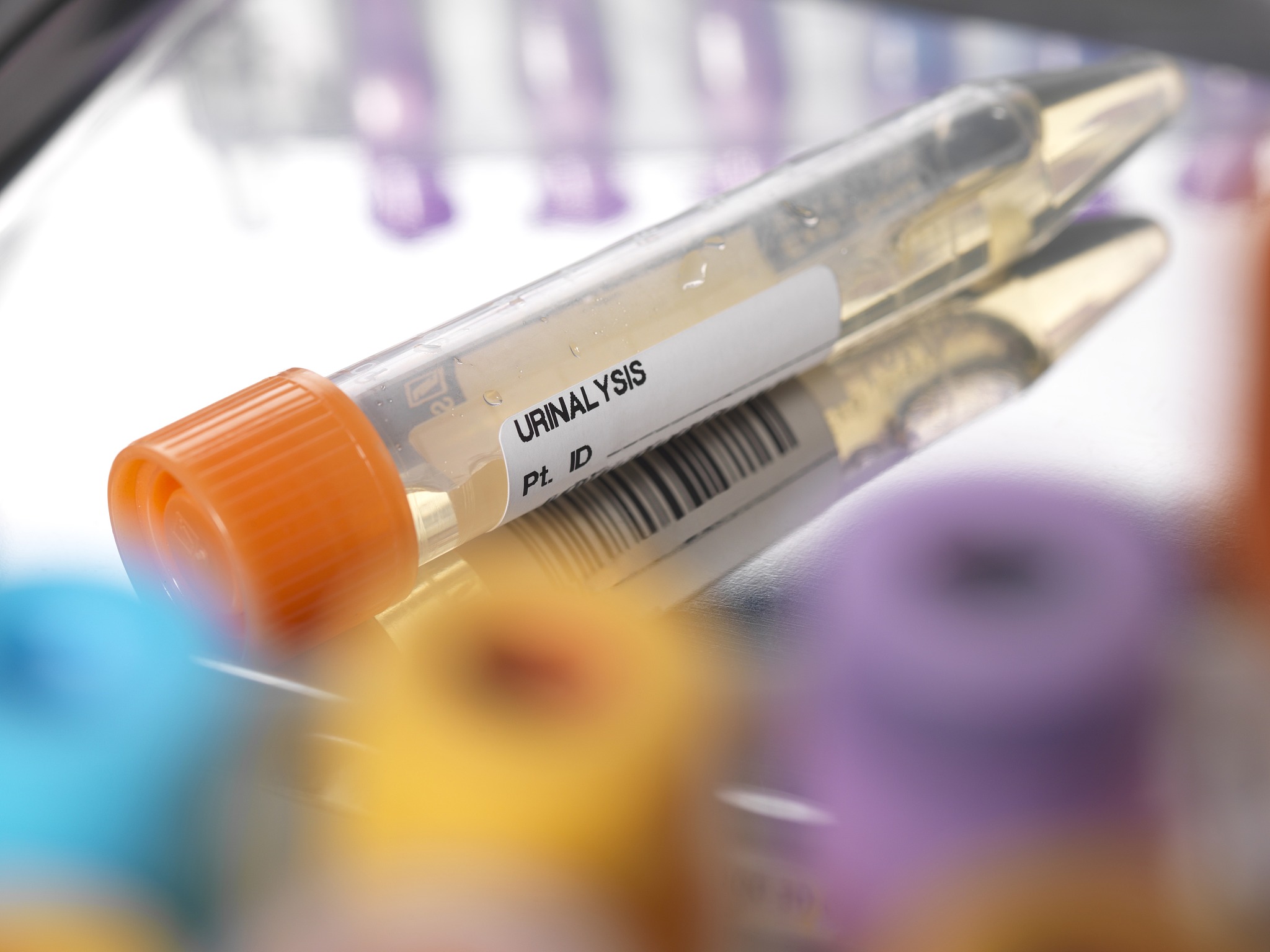 GLUTs分类：I类、II类和III类促进转运蛋白 - 葡萄糖代谢的关键角色