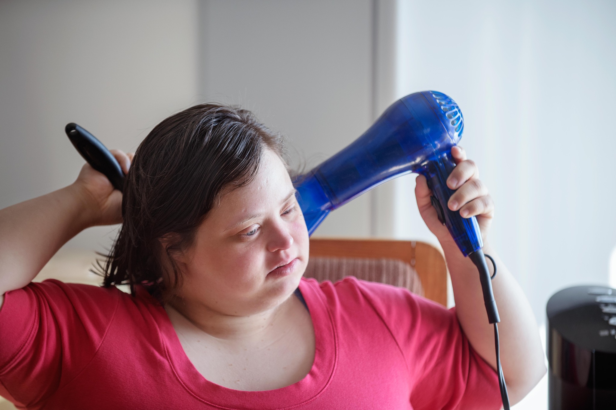 先天愚型：了解病因、症状、治疗和预防