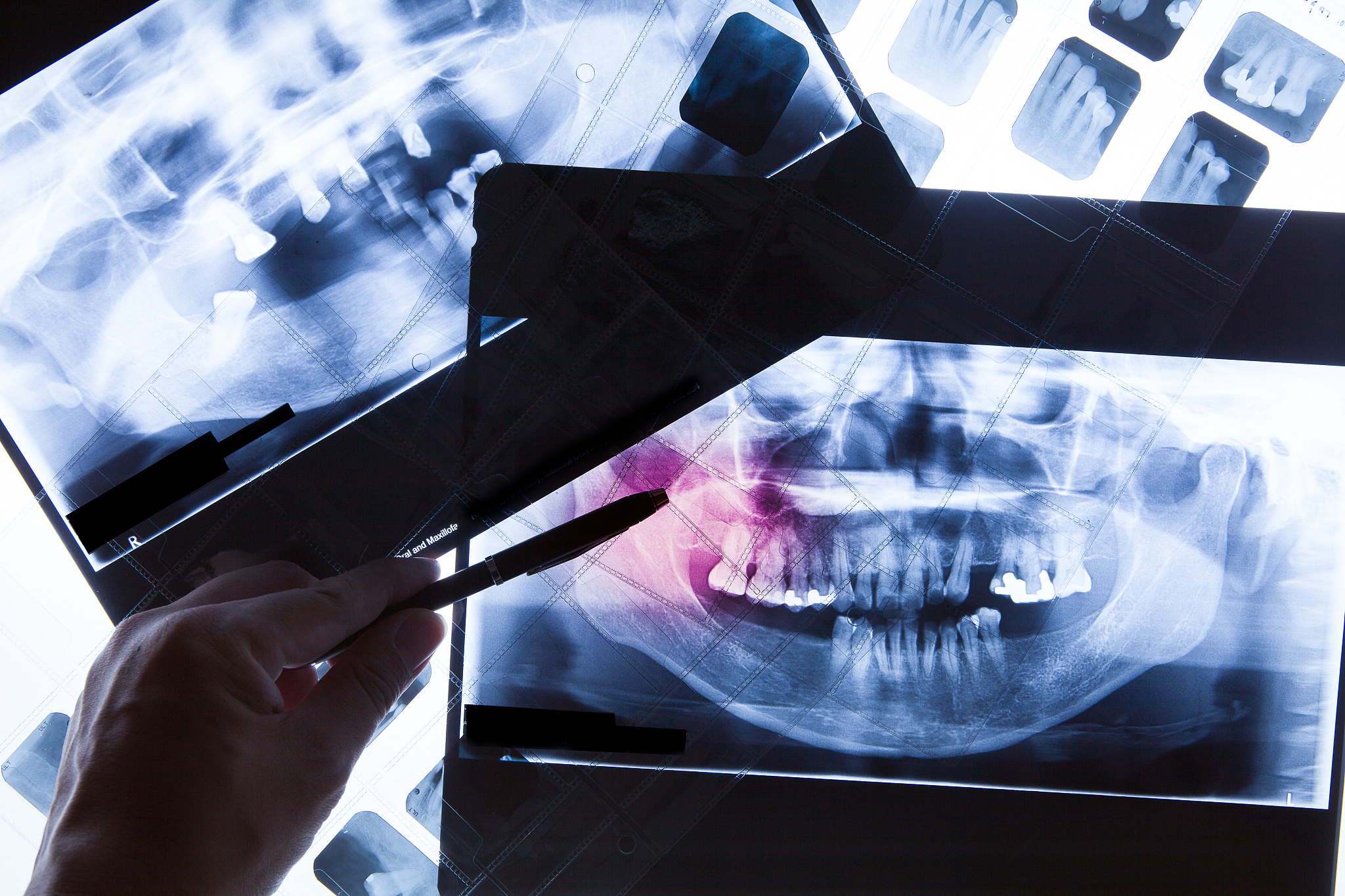 重庆高职院校卫校专业：就业前景广阔