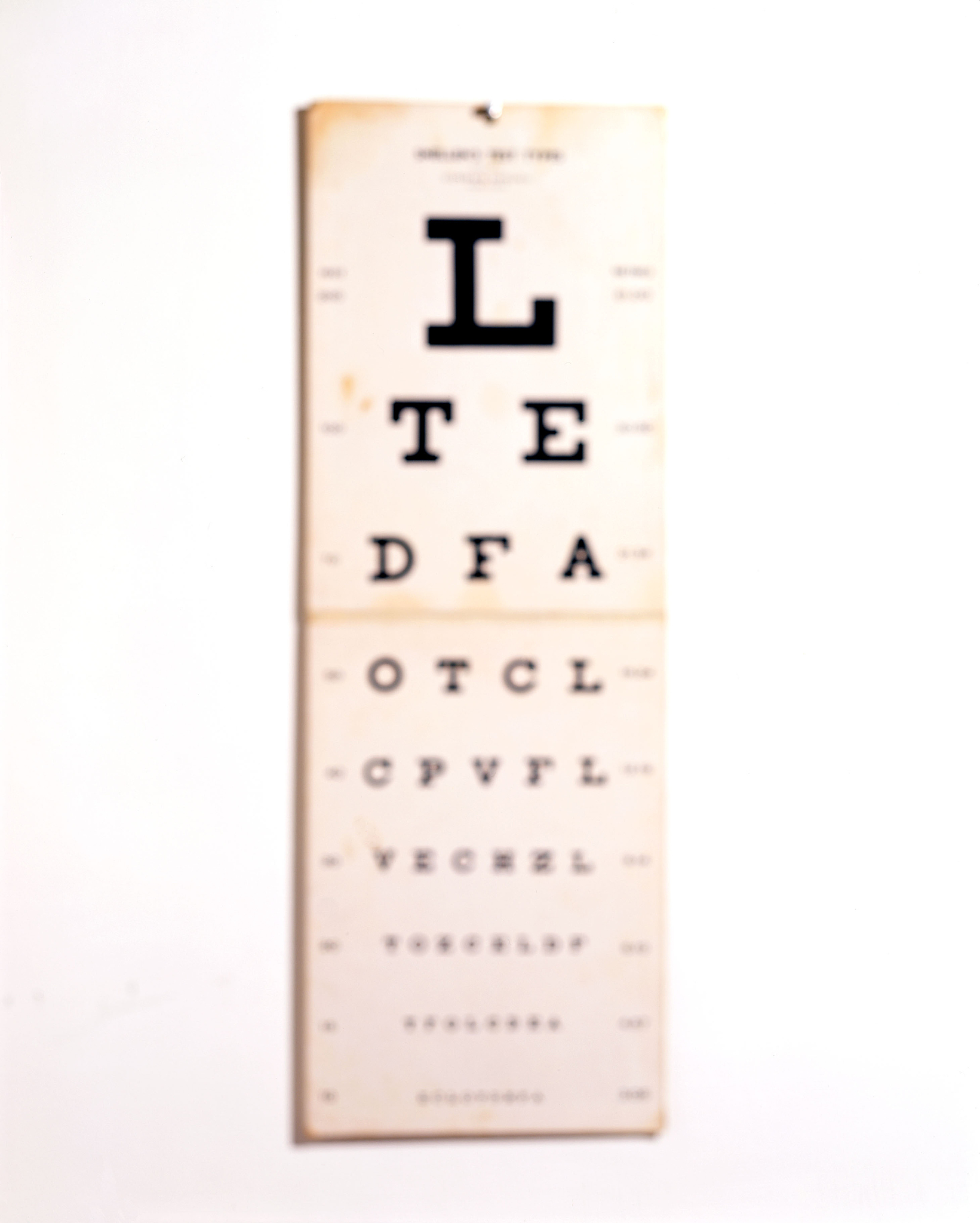 近视如何缓解疲劳